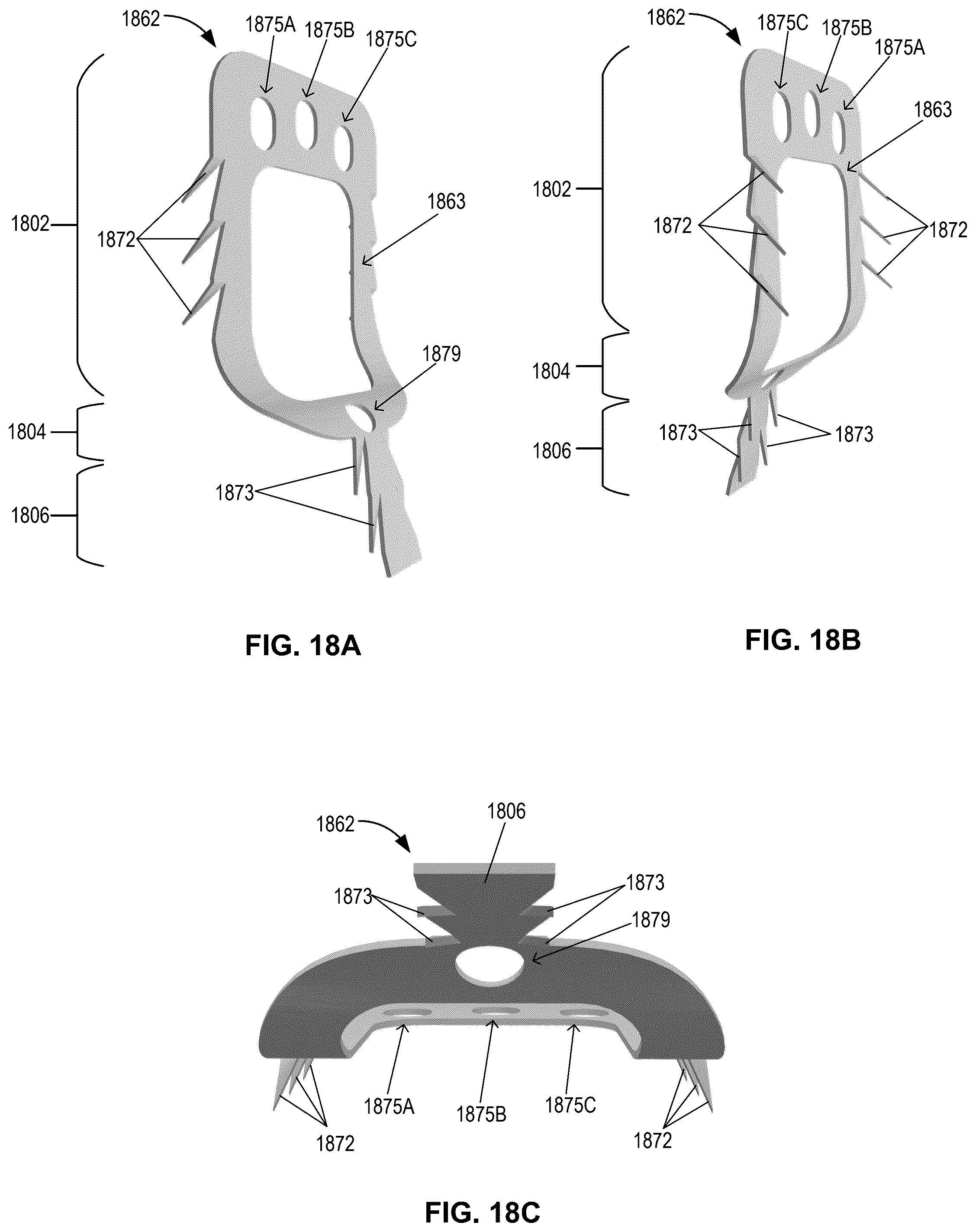Patent US12396855 Figure 19 – Systems, devices, and methods for reducing heart valve regurgitation