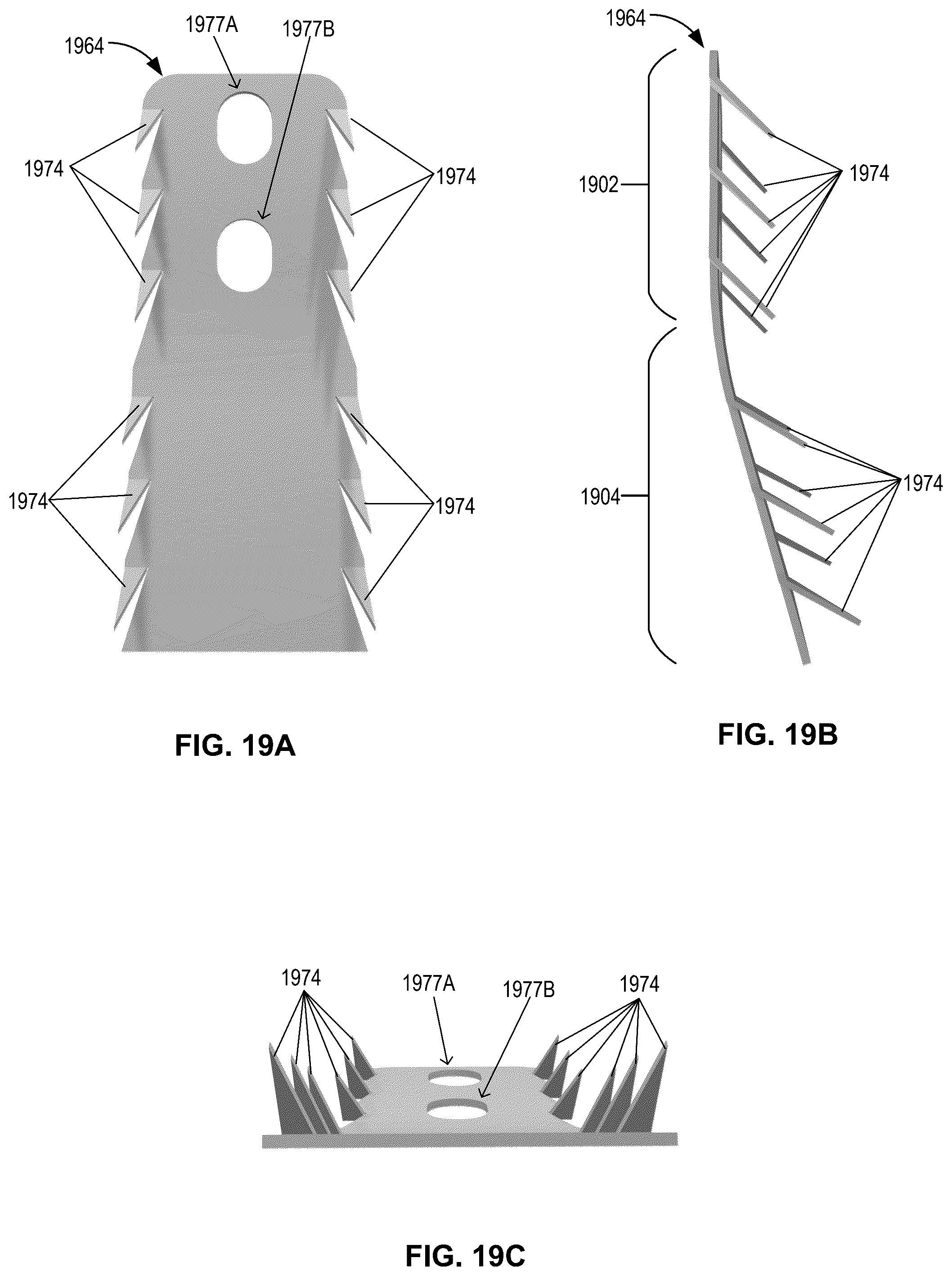 Patent US12396855 Figure 20 – Systems, devices, and methods for reducing heart valve regurgitation