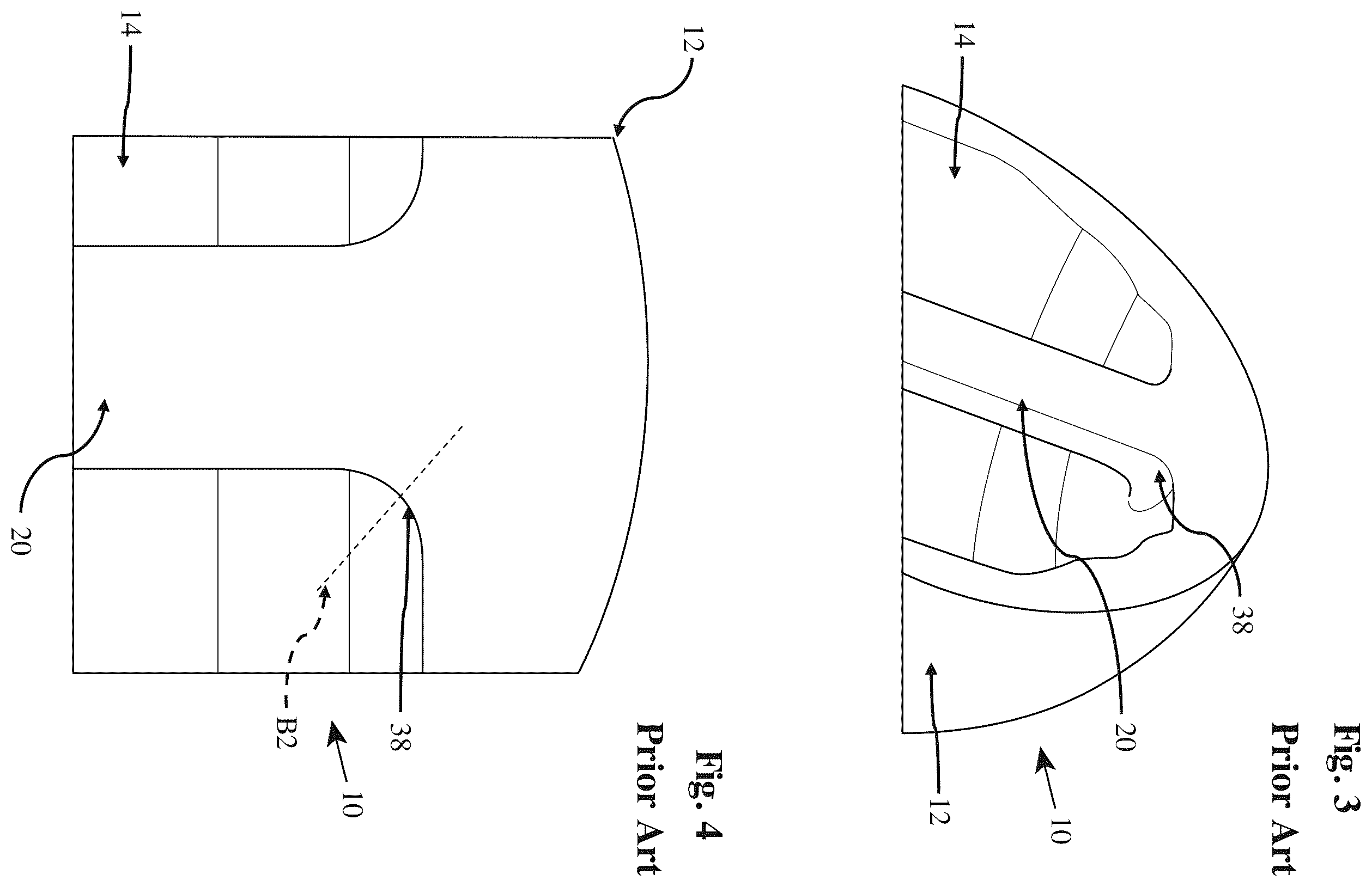 Patent US12396856 Figure 2 – Ceramic femoral resurfacing head prosthesis