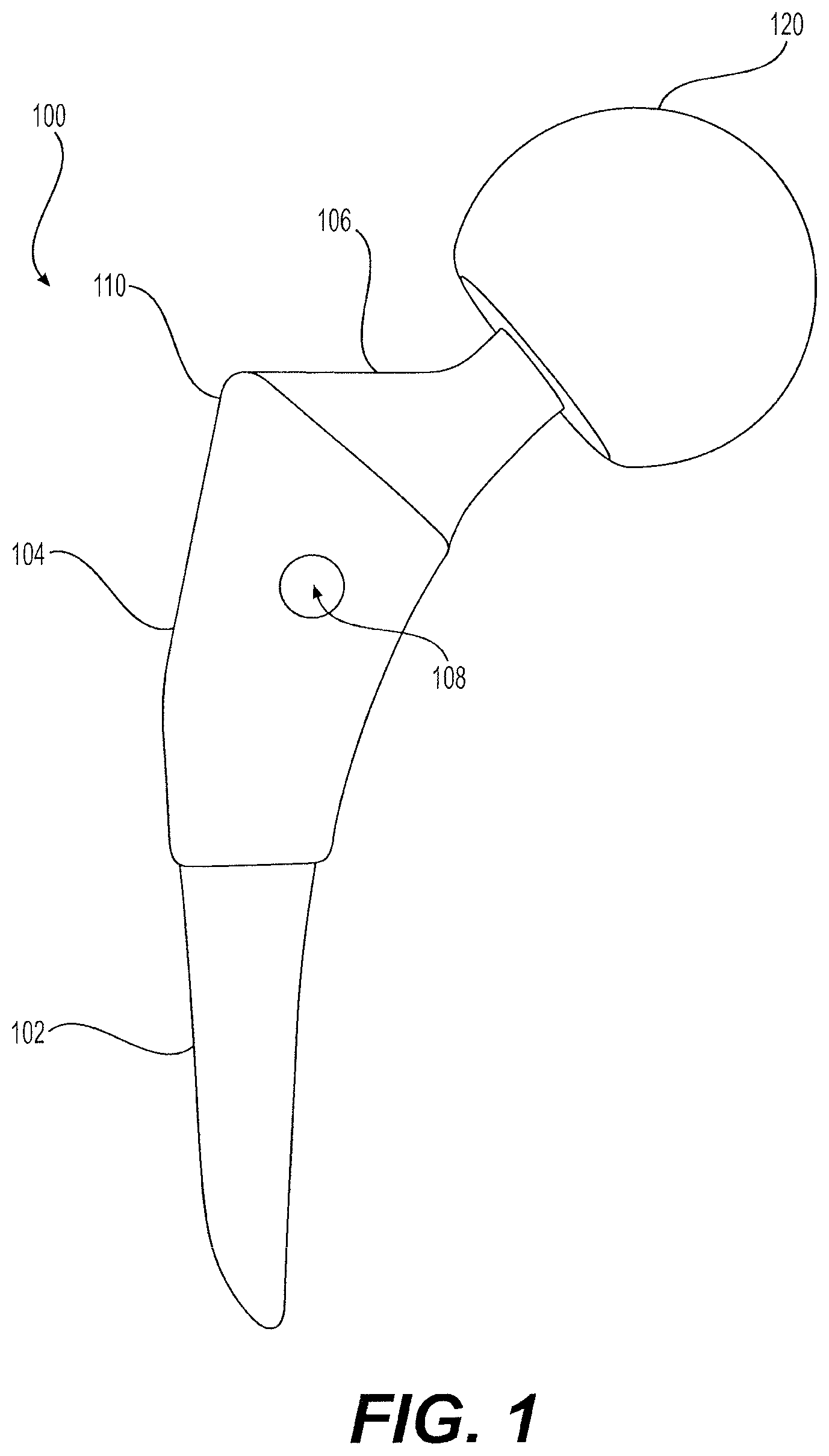 Patent US12396857 Figure 1 – Proximally fitting femoral component with adjunctive screw fixation