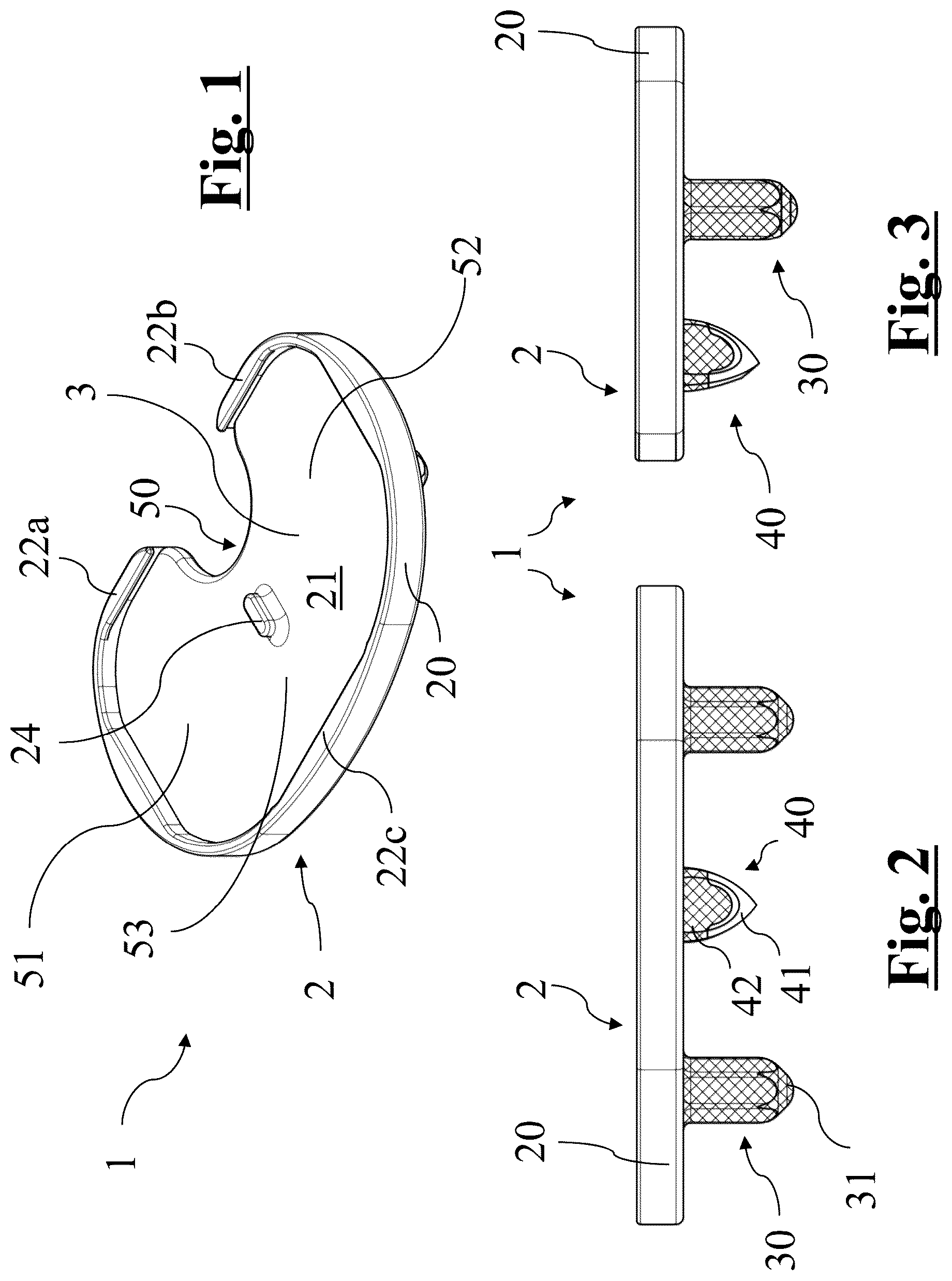 Patent US12396858 Figure 1 – Tibial baseplate for tibial component of a knee prosthesis, tibial component comprising the tibial baseplate and method for manufacturing the tibial baseplate