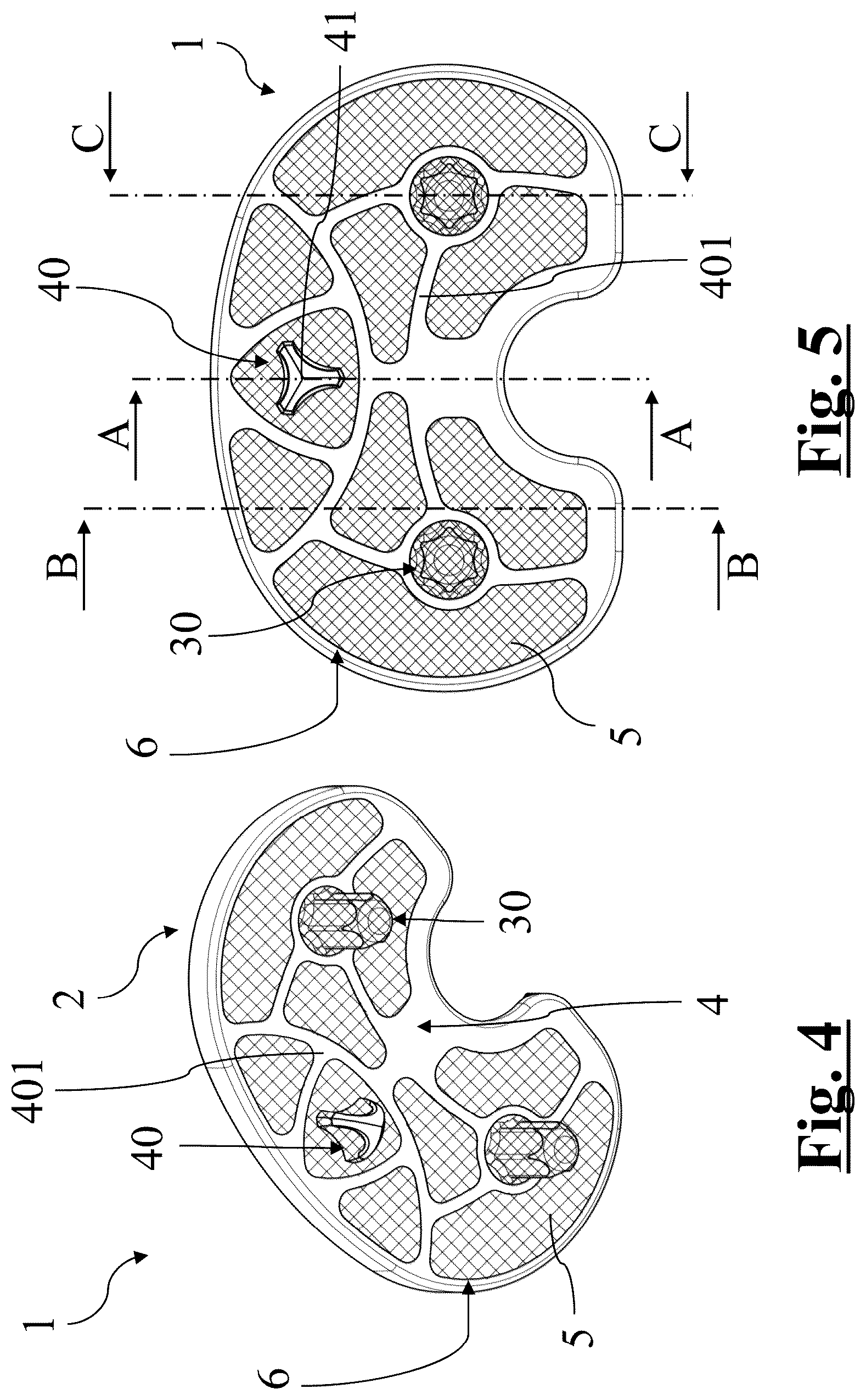 Patent US12396858 Figure 2 – Tibial baseplate for tibial component of a knee prosthesis, tibial component comprising the tibial baseplate and method for manufacturing the tibial baseplate