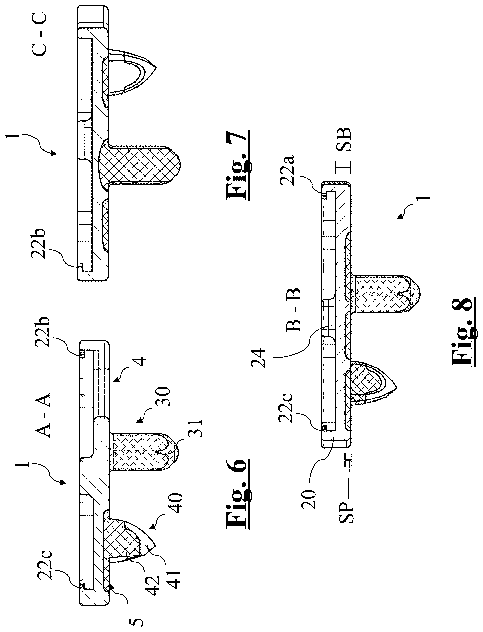 Patent US12396858 Figure 3 – Tibial baseplate for tibial component of a knee prosthesis, tibial component comprising the tibial baseplate and method for manufacturing the tibial baseplate