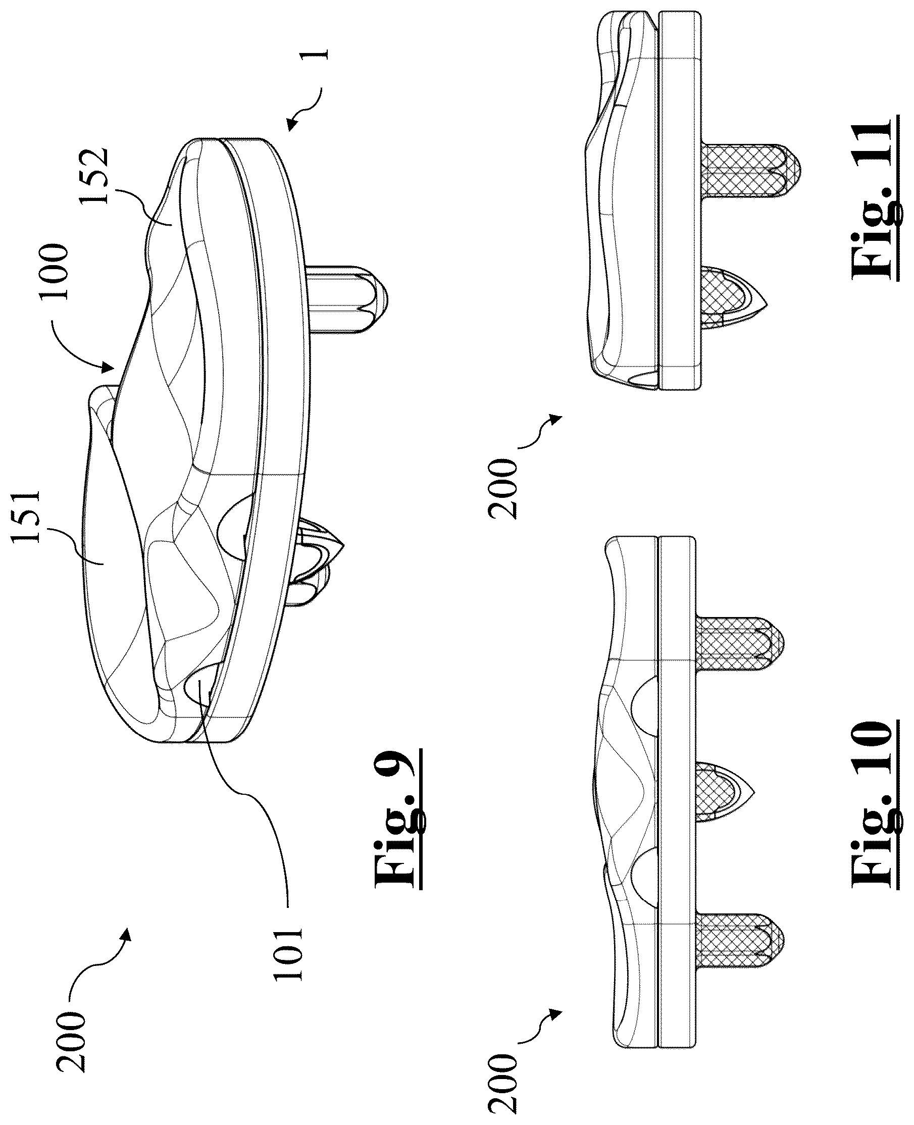 Patent US12396858 Figure 4 – Tibial baseplate for tibial component of a knee prosthesis, tibial component comprising the tibial baseplate and method for manufacturing the tibial baseplate