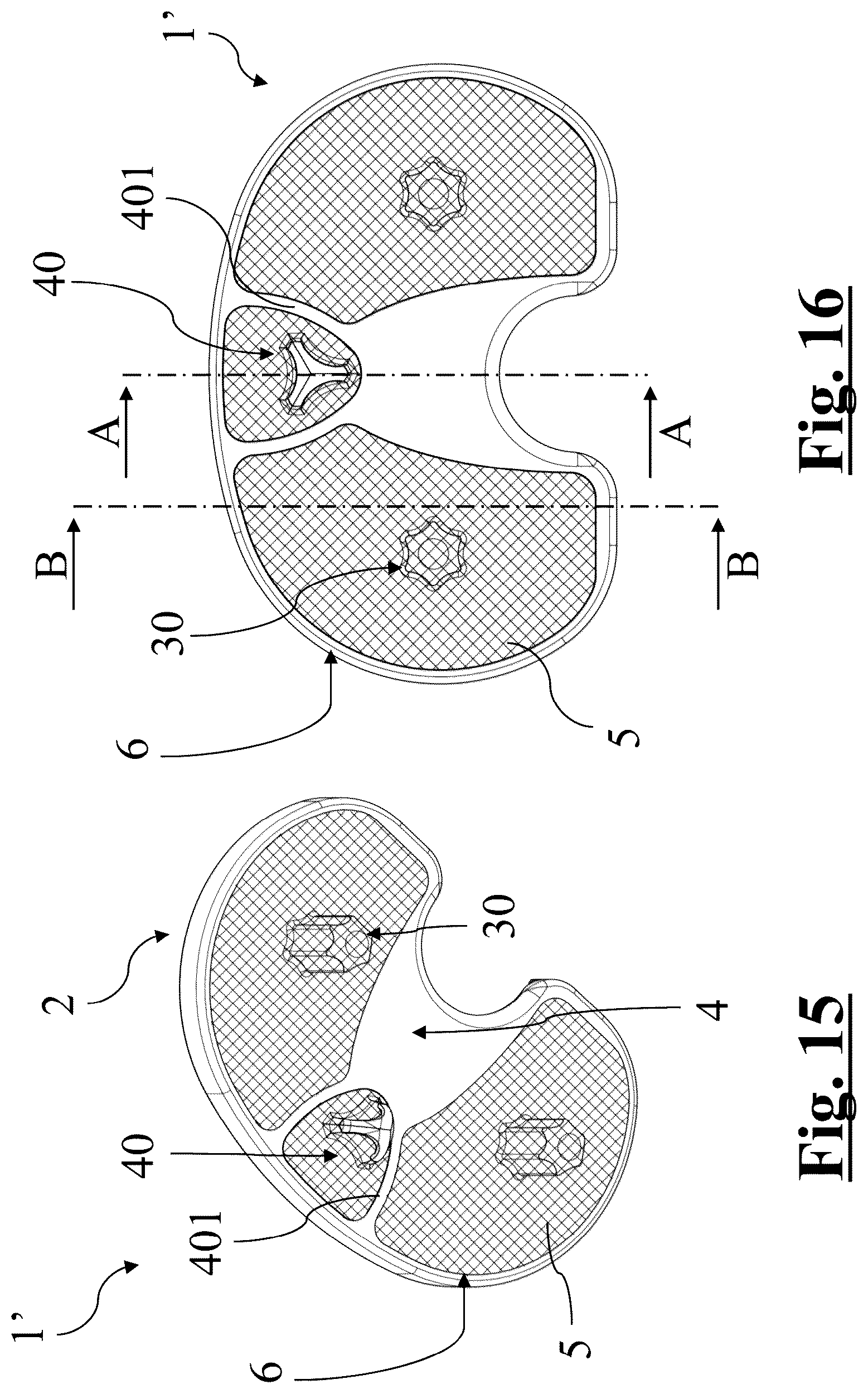 Patent US12396858 Figure 6 – Tibial baseplate for tibial component of a knee prosthesis, tibial component comprising the tibial baseplate and method for manufacturing the tibial baseplate