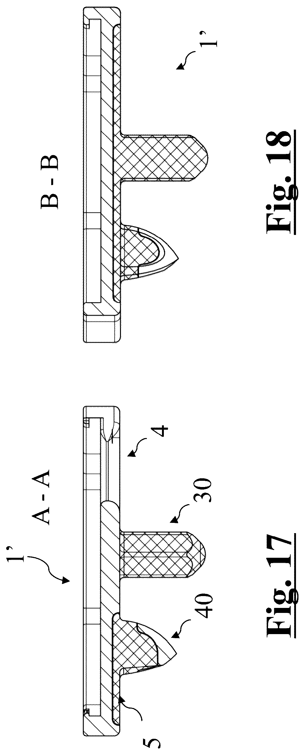 Patent US12396858 Figure 7 – Tibial baseplate for tibial component of a knee prosthesis, tibial component comprising the tibial baseplate and method for manufacturing the tibial baseplate