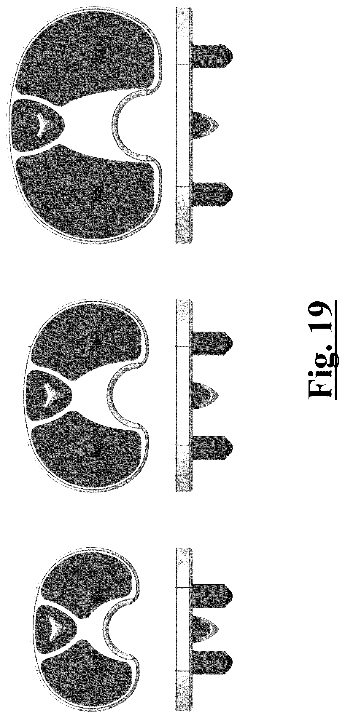 Patent US12396858 Figure 8 – Tibial baseplate for tibial component of a knee prosthesis, tibial component comprising the tibial baseplate and method for manufacturing the tibial baseplate