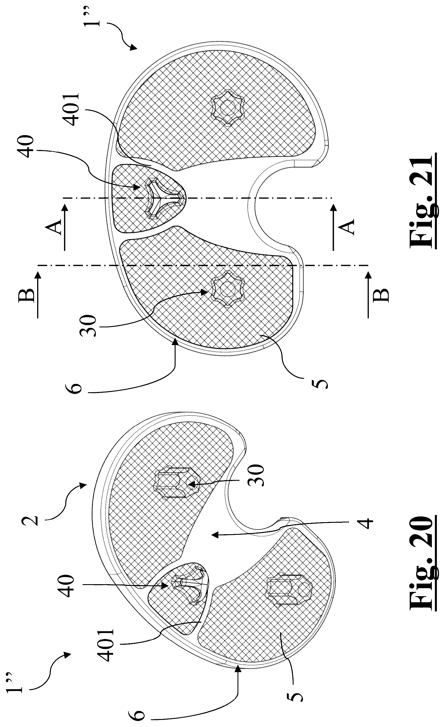 Patent US12396858 Figure 9 – Tibial baseplate for tibial component of a knee prosthesis, tibial component comprising the tibial baseplate and method for manufacturing the tibial baseplate