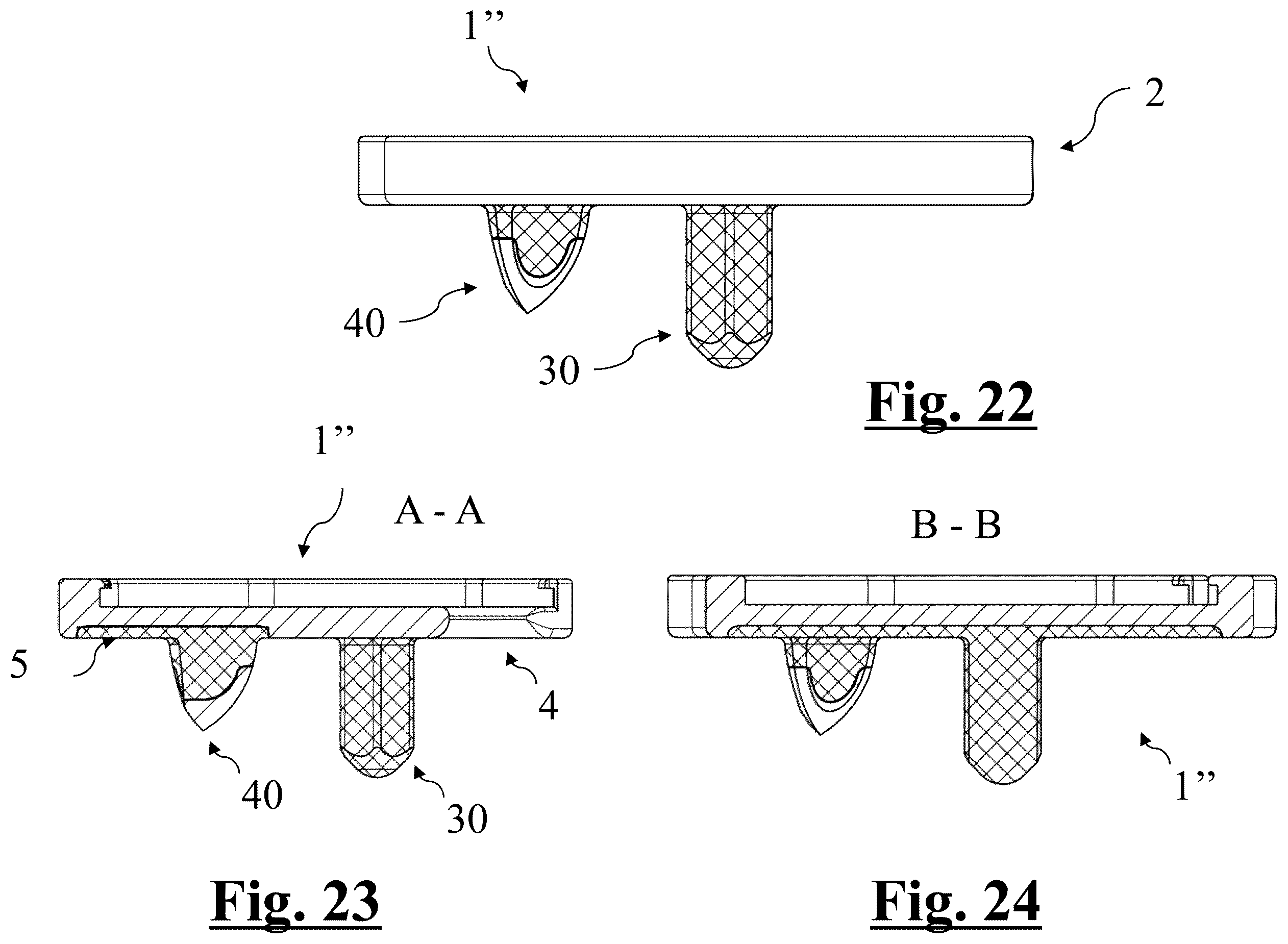 Patent US12396858 Figure 10 – Tibial baseplate for tibial component of a knee prosthesis, tibial component comprising the tibial baseplate and method for manufacturing the tibial baseplate