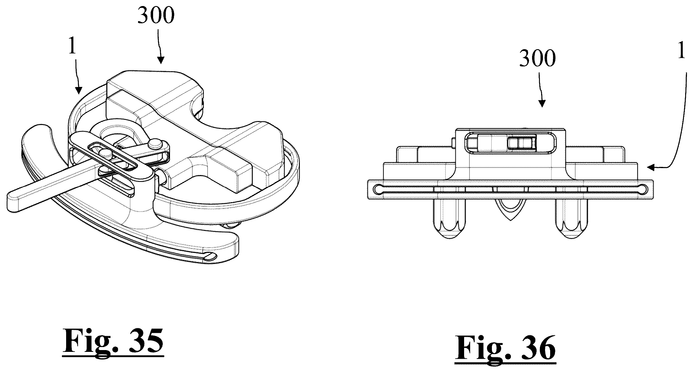 Patent US12396858 Figure 15 – Tibial baseplate for tibial component of a knee prosthesis, tibial component comprising the tibial baseplate and method for manufacturing the tibial baseplate