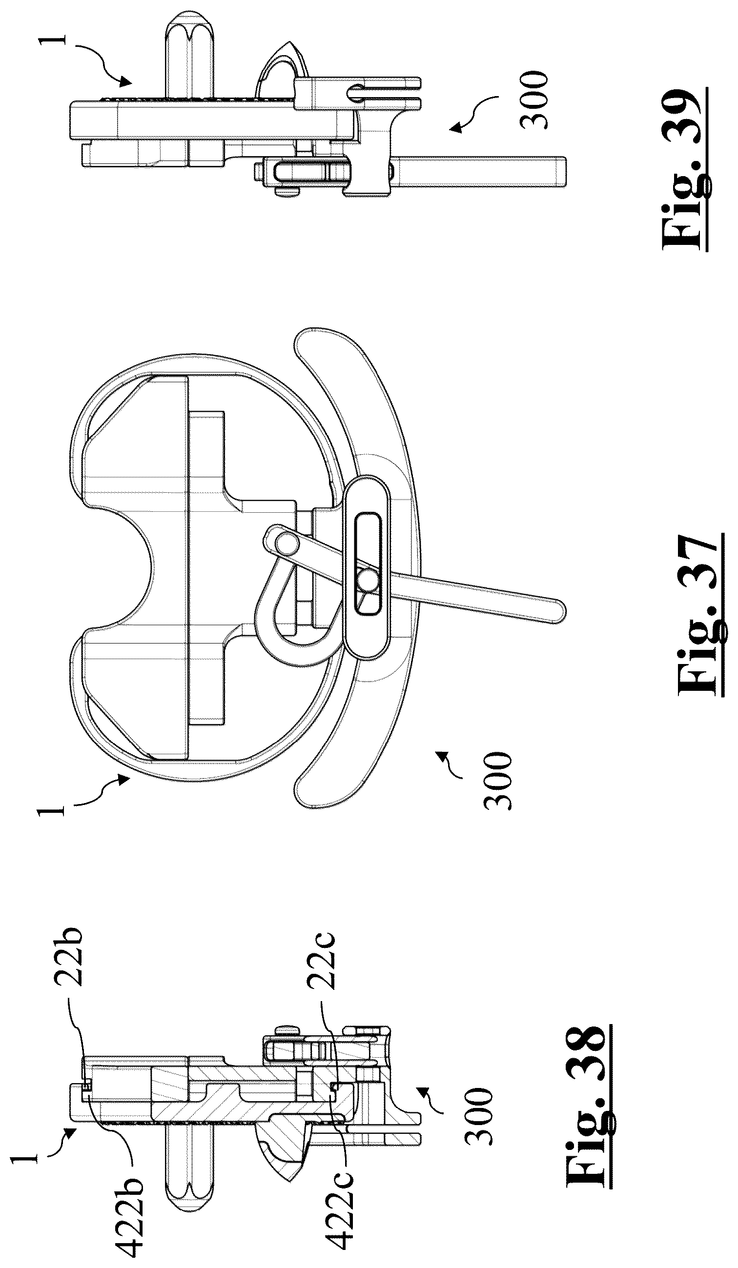 Patent US12396858 Figure 16 – Tibial baseplate for tibial component of a knee prosthesis, tibial component comprising the tibial baseplate and method for manufacturing the tibial baseplate