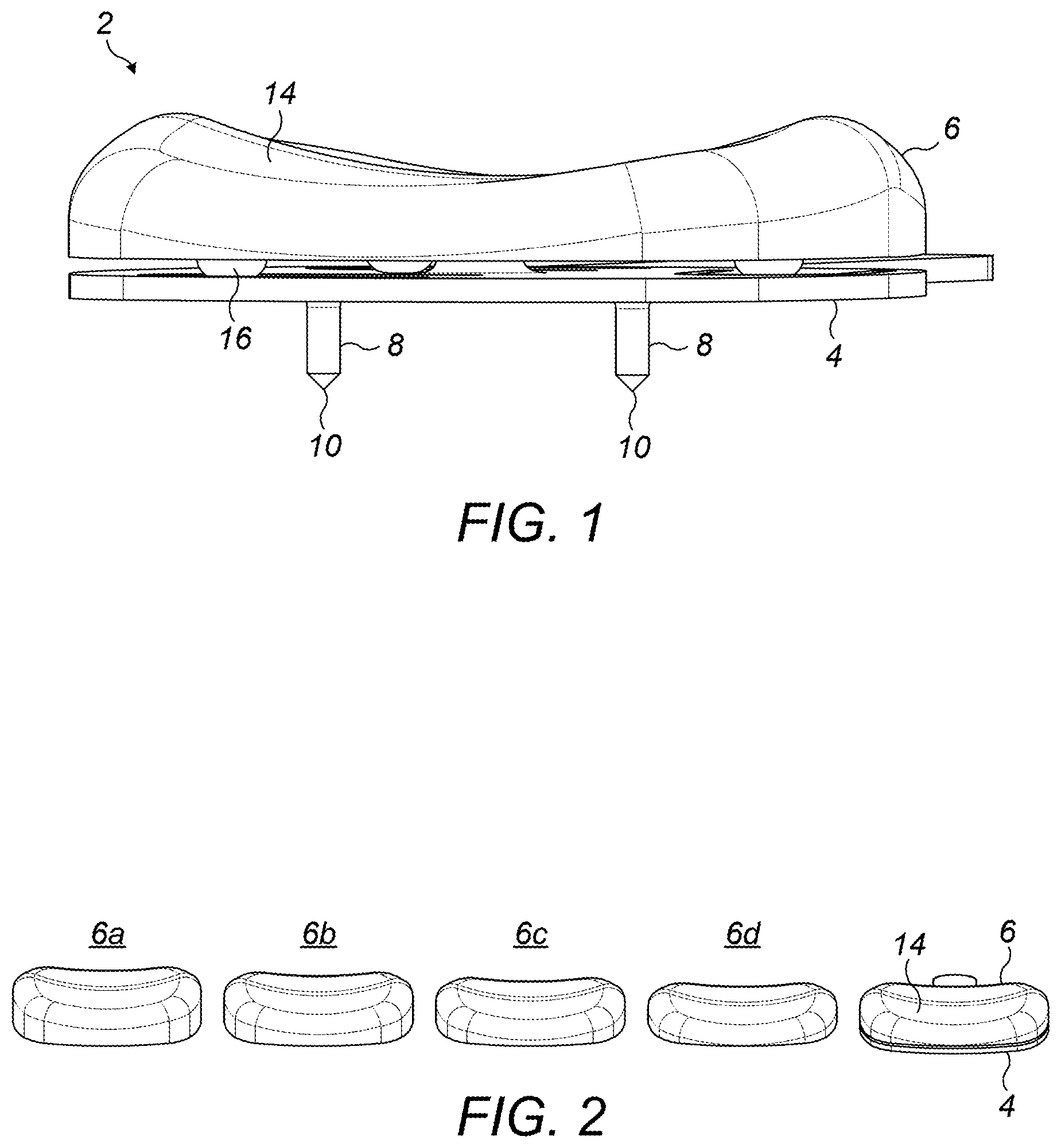 Patent US12396859 Figure 1 – Trial patella component kit