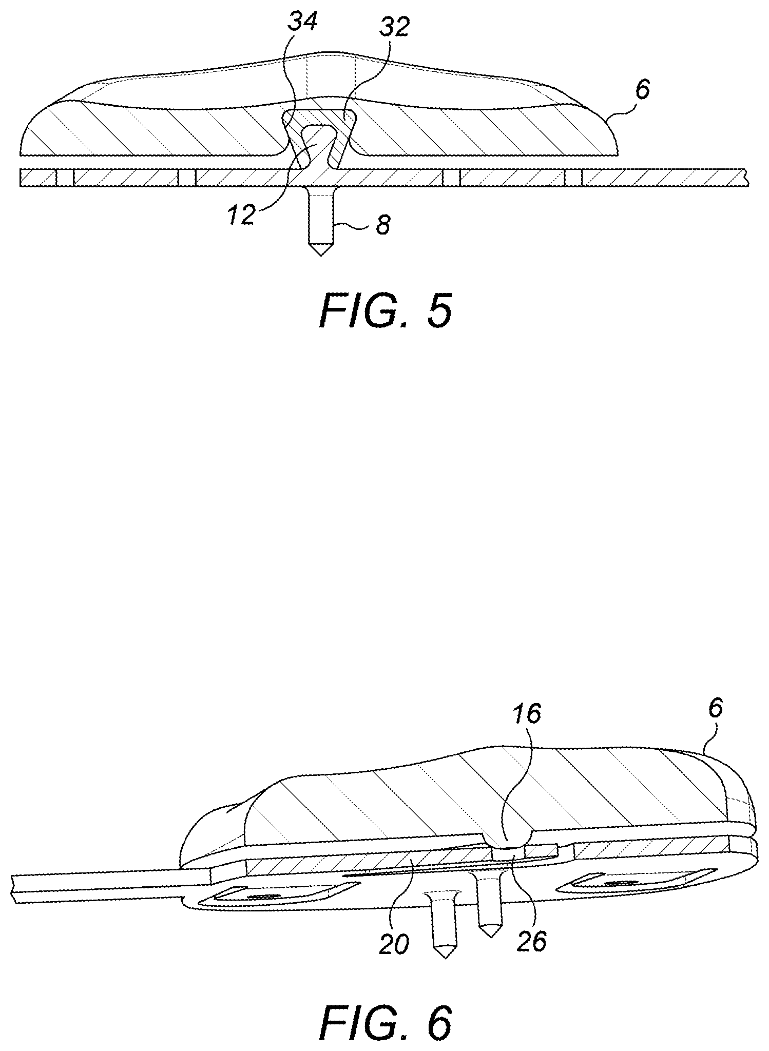 Patent US12396859 Figure 3 – Trial patella component kit