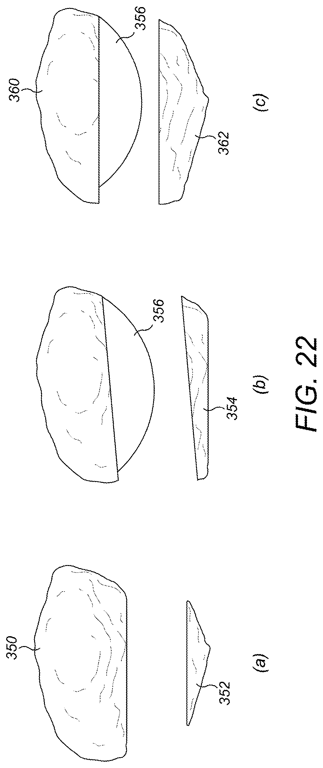 Patent US12396859 Figure 13 – Trial patella component kit