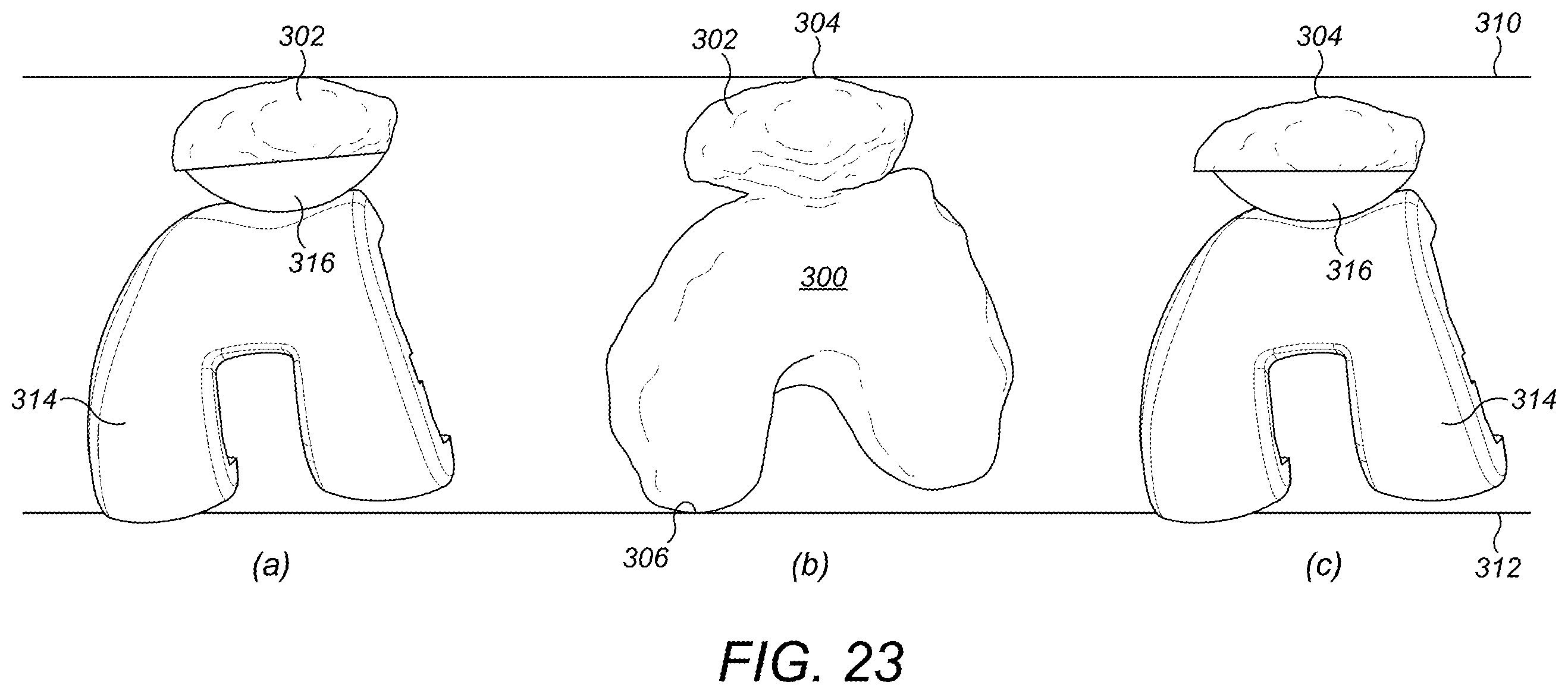 Patent US12396859 Figure 14 – Trial patella component kit