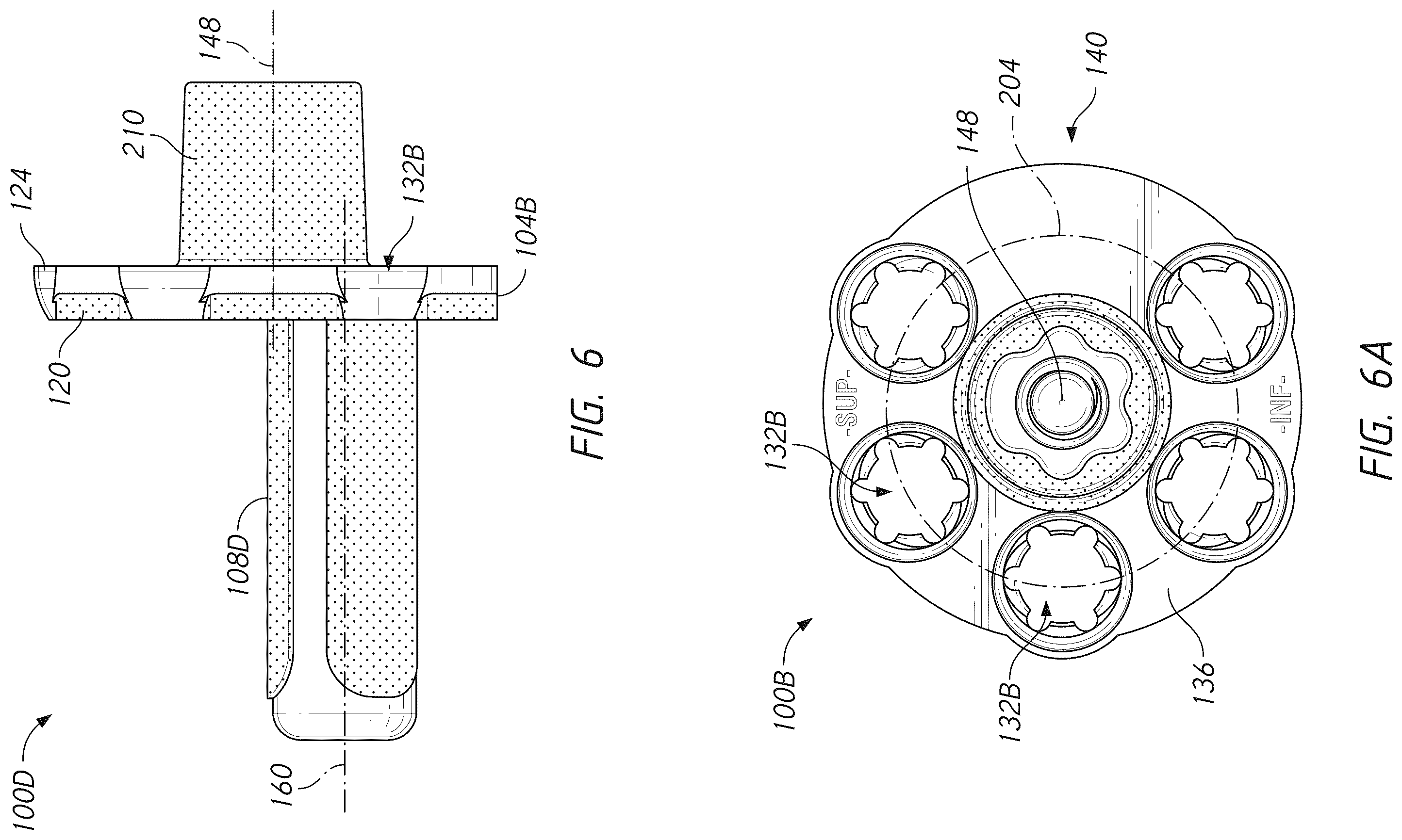 Patent US12396862 Figure 10 – Glenoid baseplate and implant assemblies