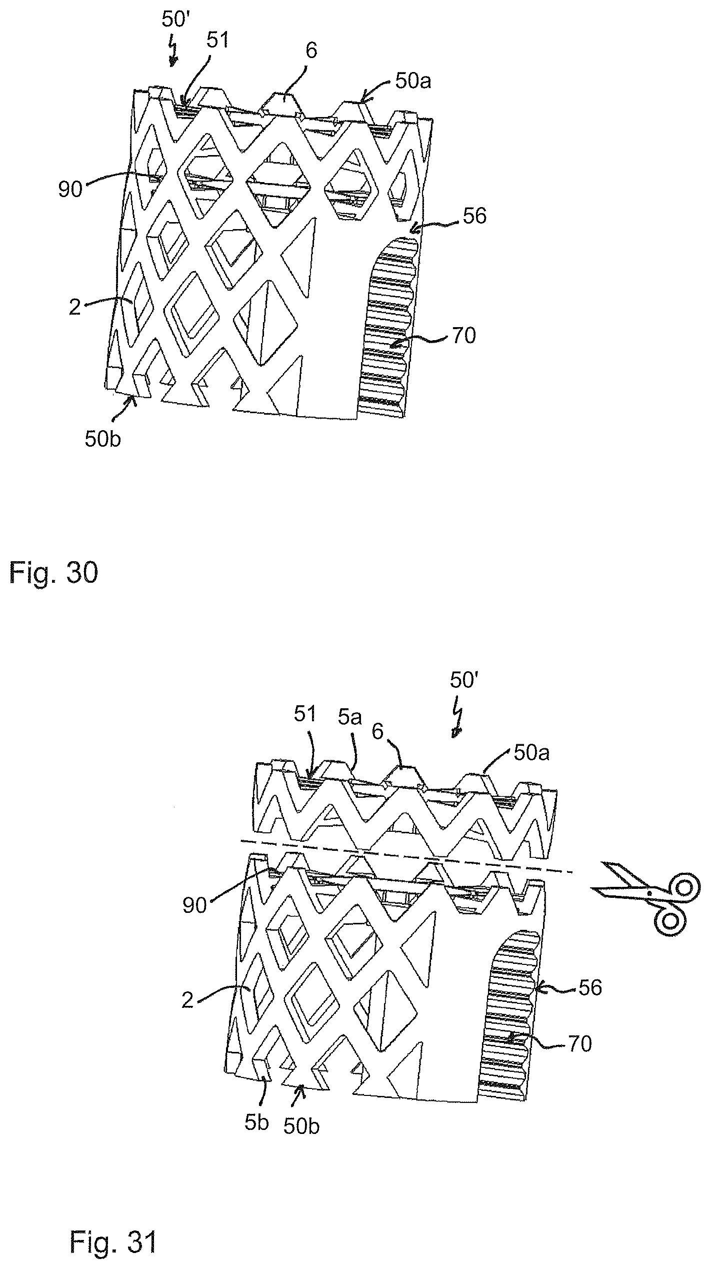 Patent US12396864 Figure 10 – Implant for engagement between vertebrae, and implant kit