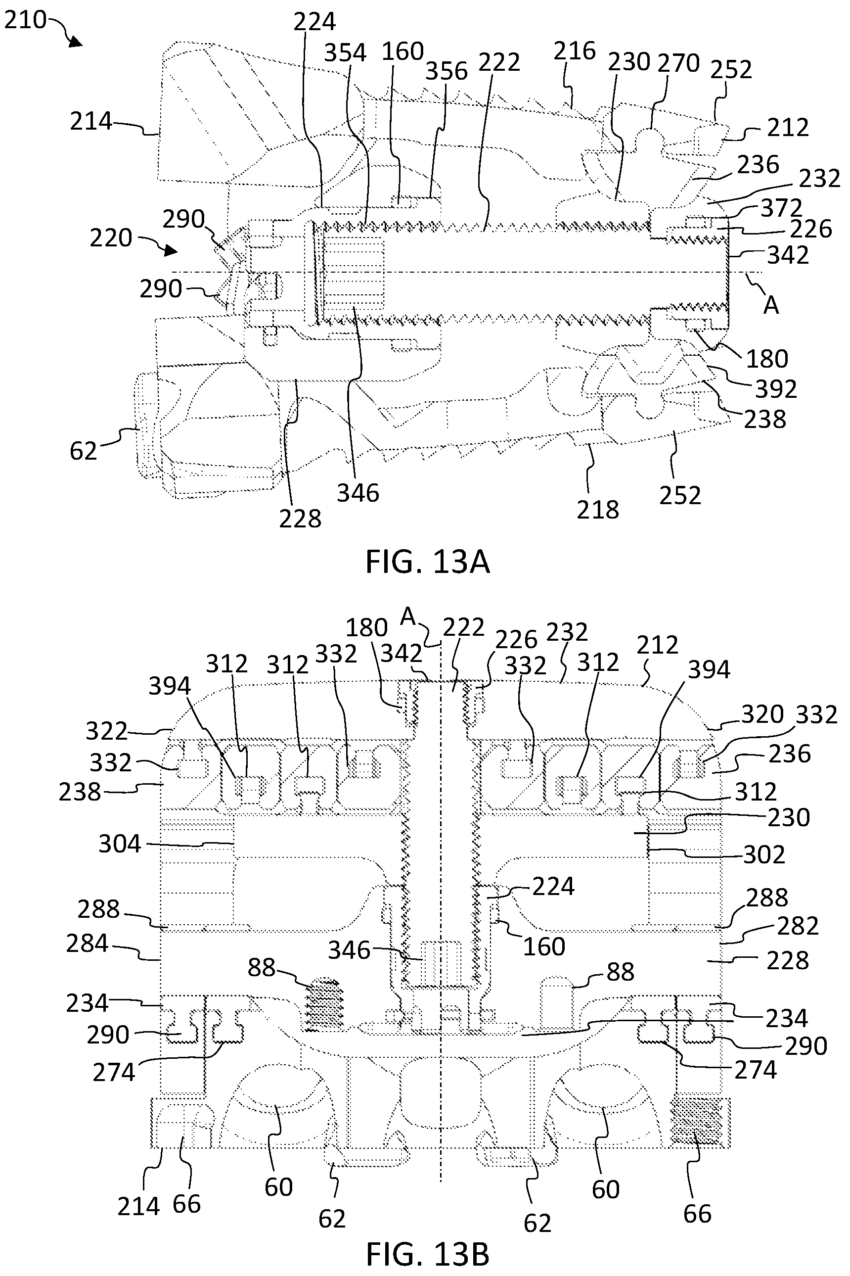 Patent US12396866 Figure 13 – Expandable anterior lumbar implants