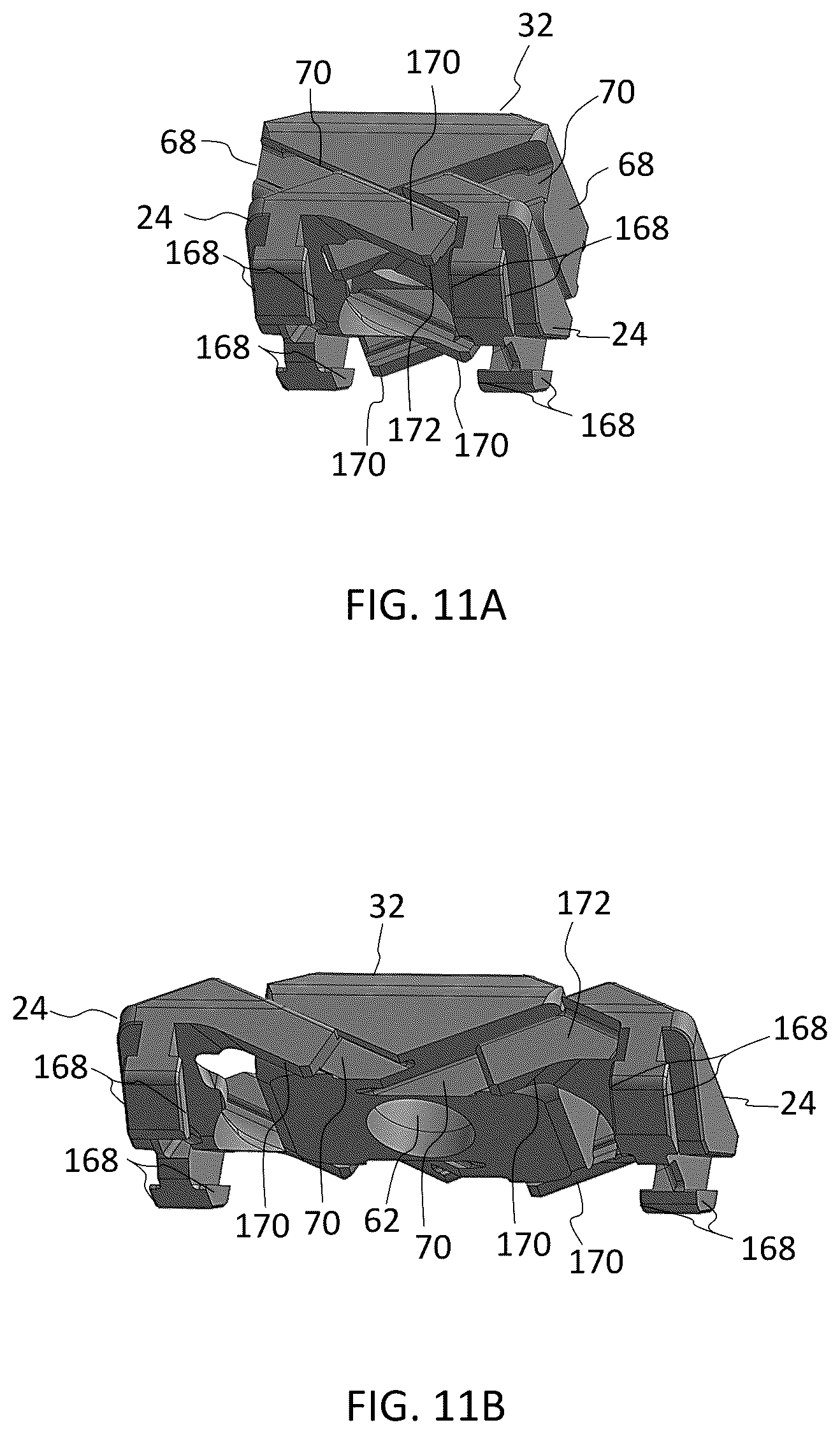 Patent US12396867 Figure 10 – Expandable footprint implant