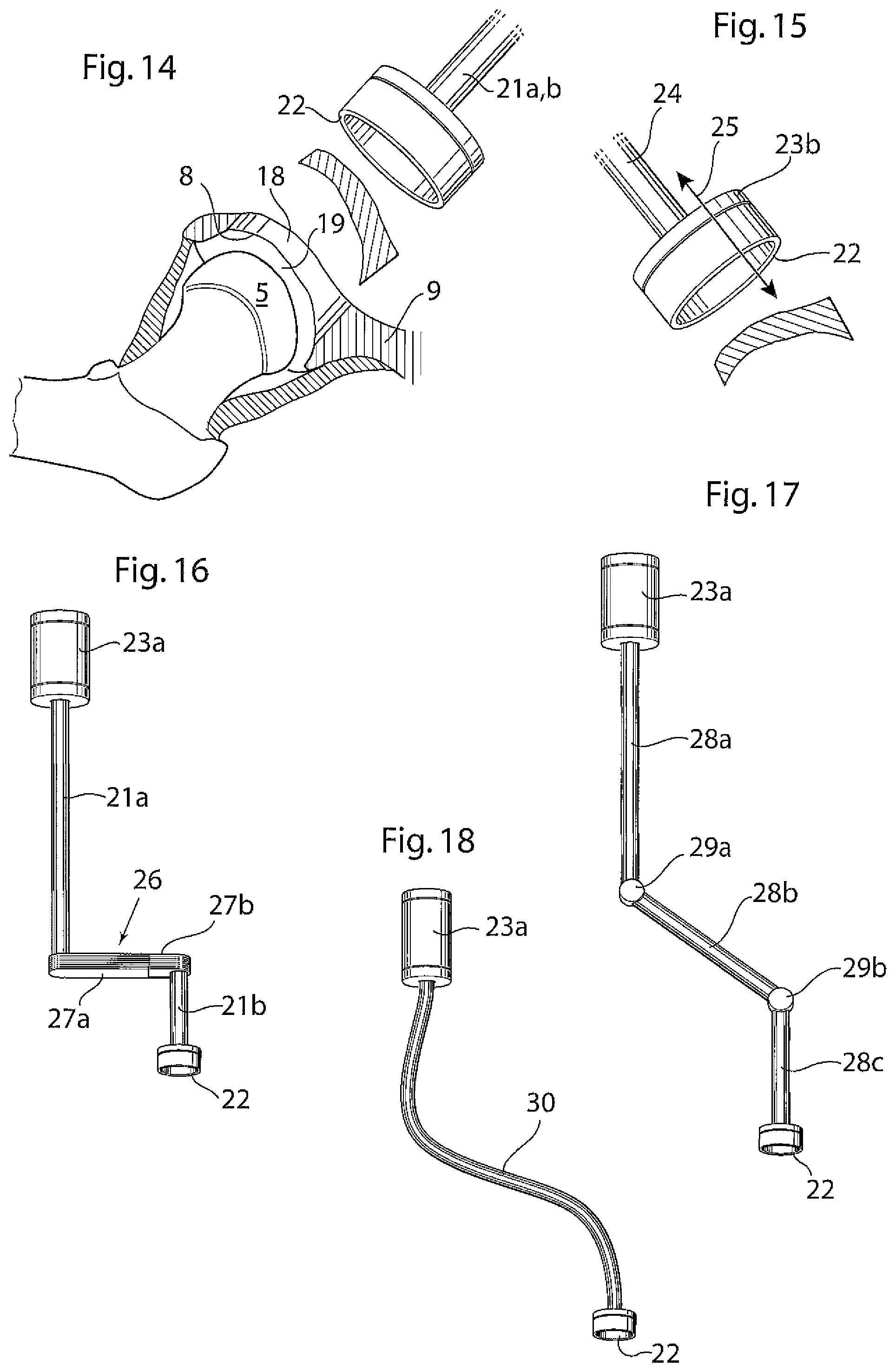 Patent US12396868 Figure 8 – Hip joint instrument and method