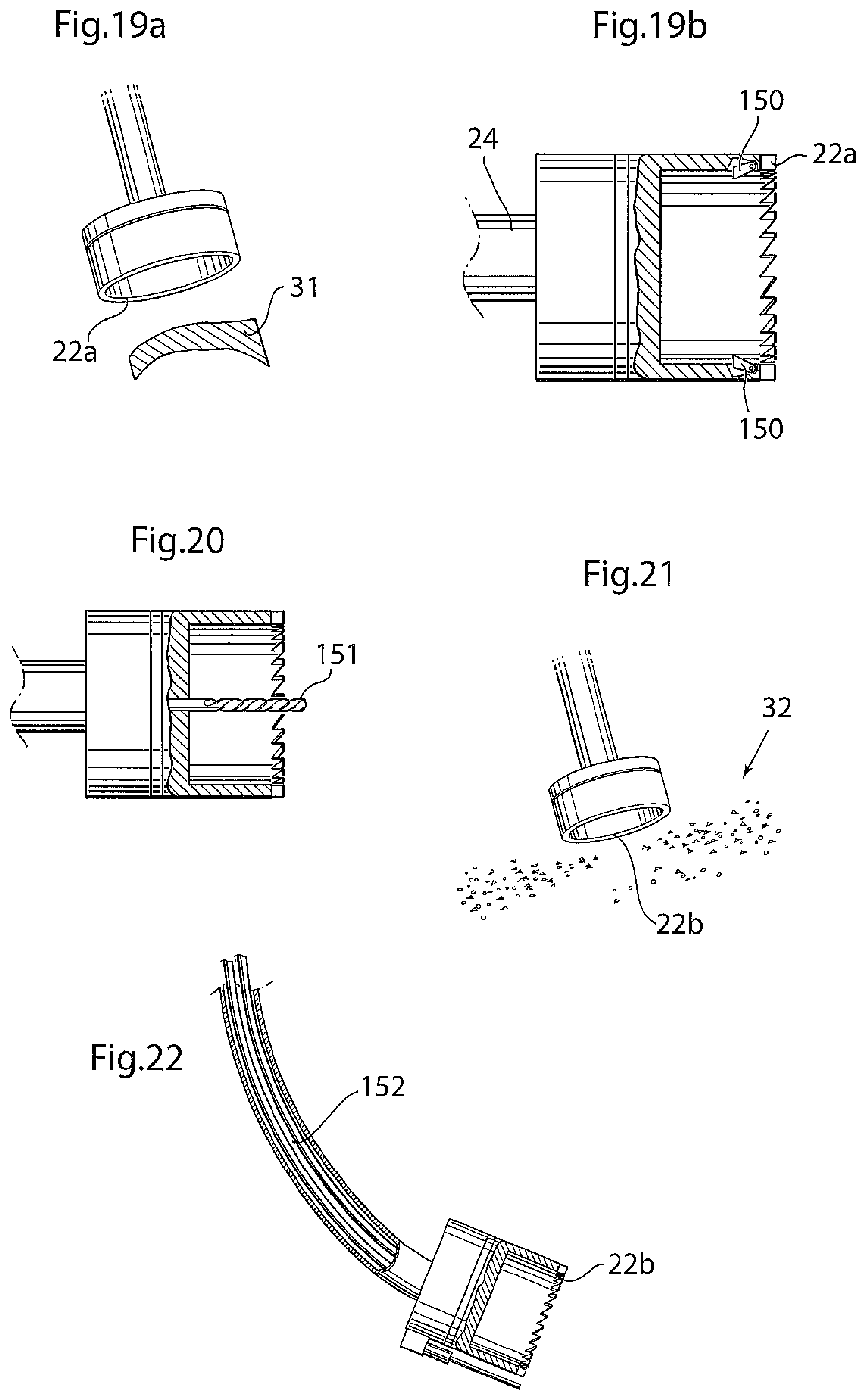 Patent US12396868 Figure 9 – Hip joint instrument and method