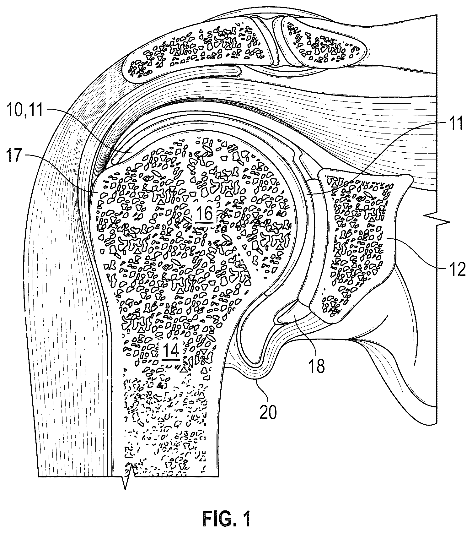 Patent US12396869 Figure 1 – Systems and methods for using image analysis to guide a surgical procedure