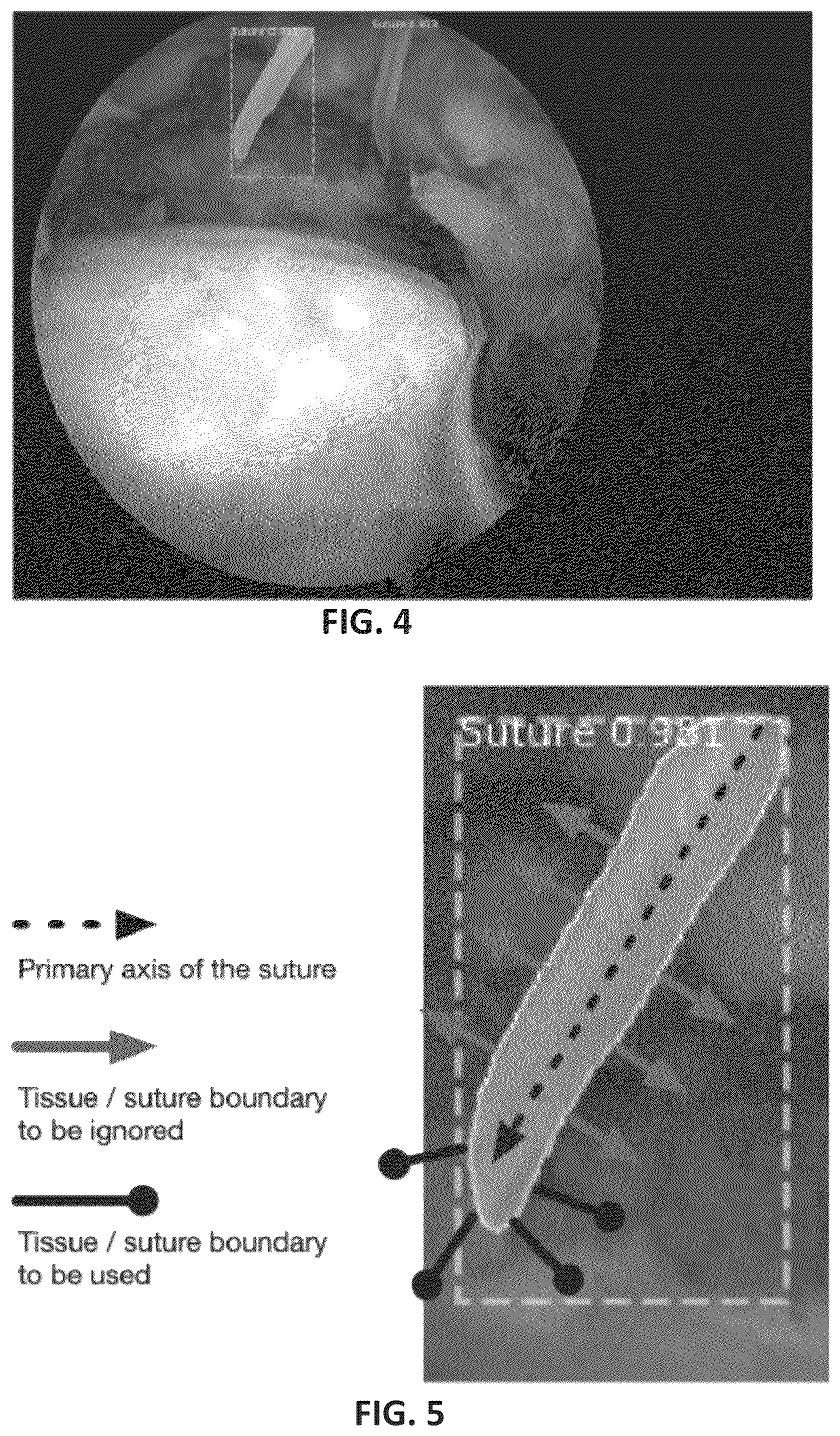 Patent US12396869 Figure 4 – Systems and methods for using image analysis to guide a surgical procedure