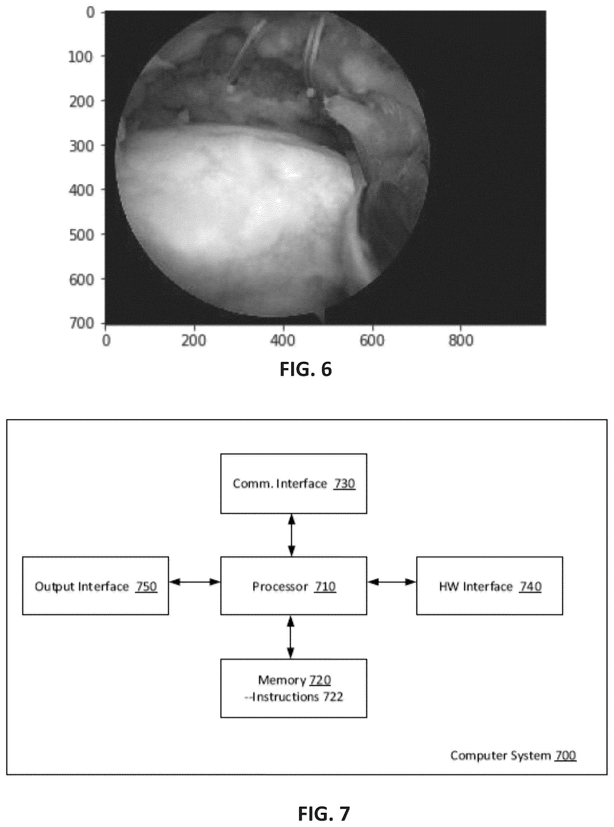 Patent US12396869 Figure 5 – Systems and methods for using image analysis to guide a surgical procedure