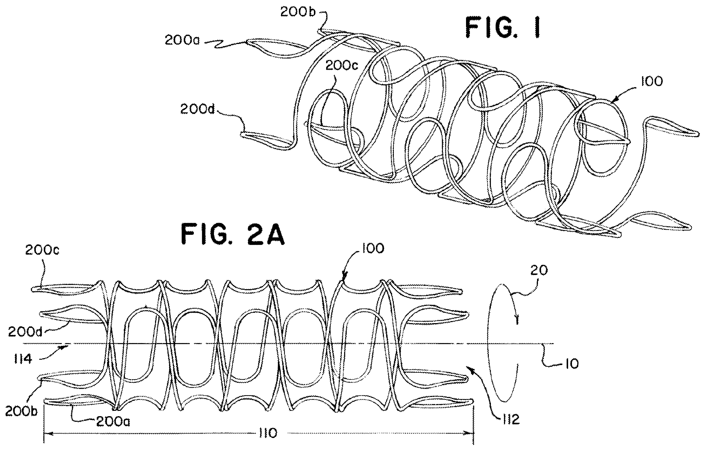 Patent US12396870 Figure 1 – Stent with shaped wires