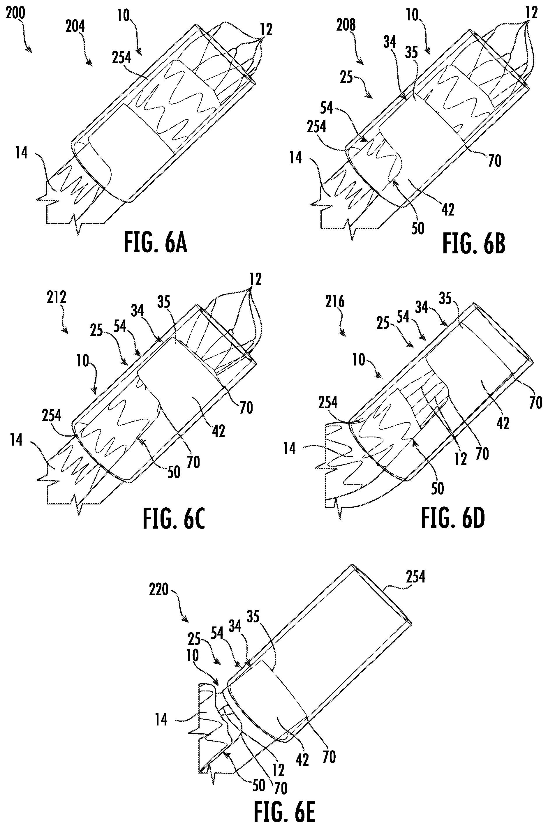 Patent US12396871 Figure 4 – Devices and methods for stent graft extraction