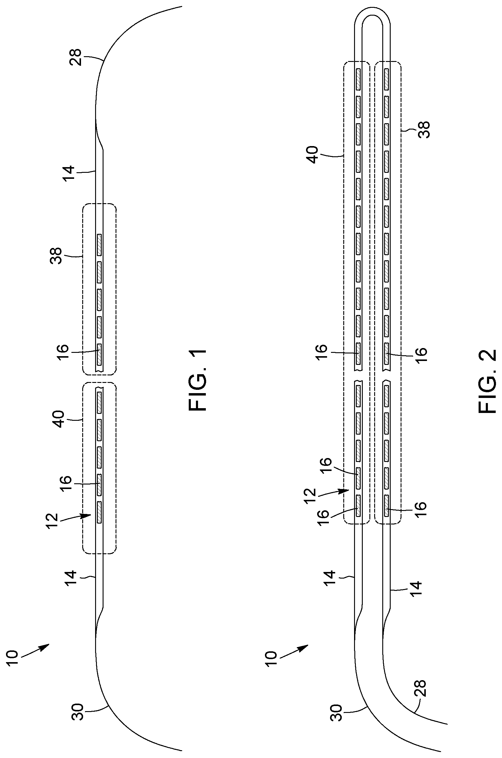Patent US12396874 Figure 1 – Magnetic devices for digestive tract partitioning