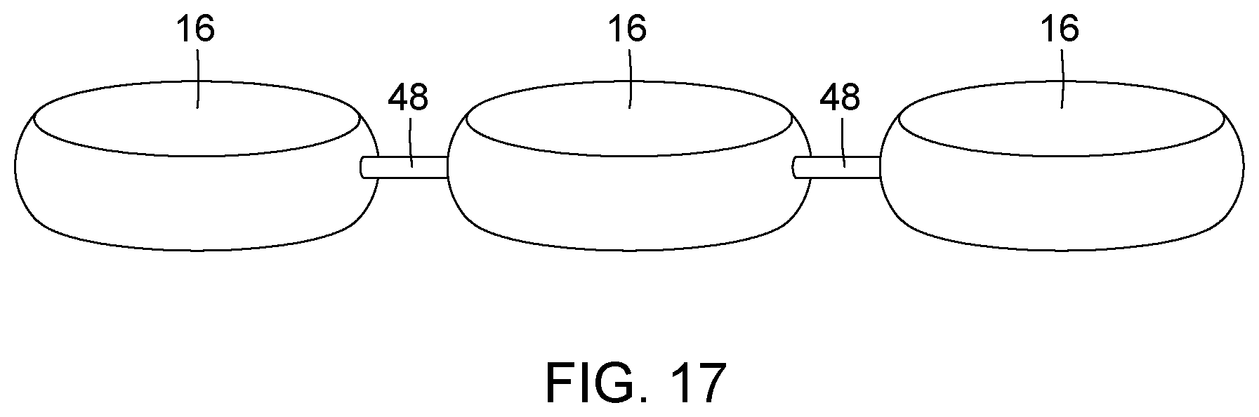Patent US12396874 Figure 11 – Magnetic devices for digestive tract partitioning