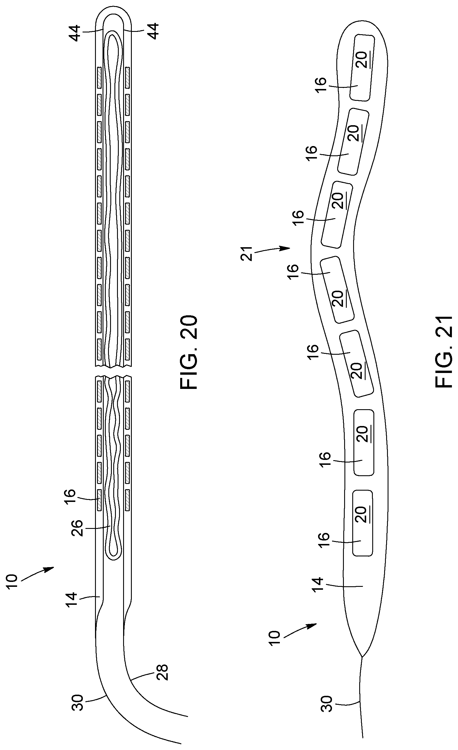 Patent US12396874 Figure 13 – Magnetic devices for digestive tract partitioning