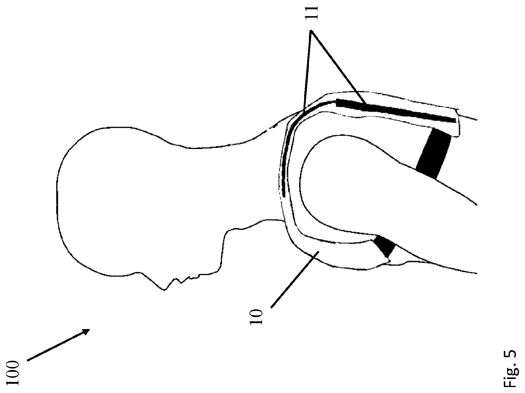 Patent US12396875 Figure 5 – Body support device, the use of it and a method of handling loads