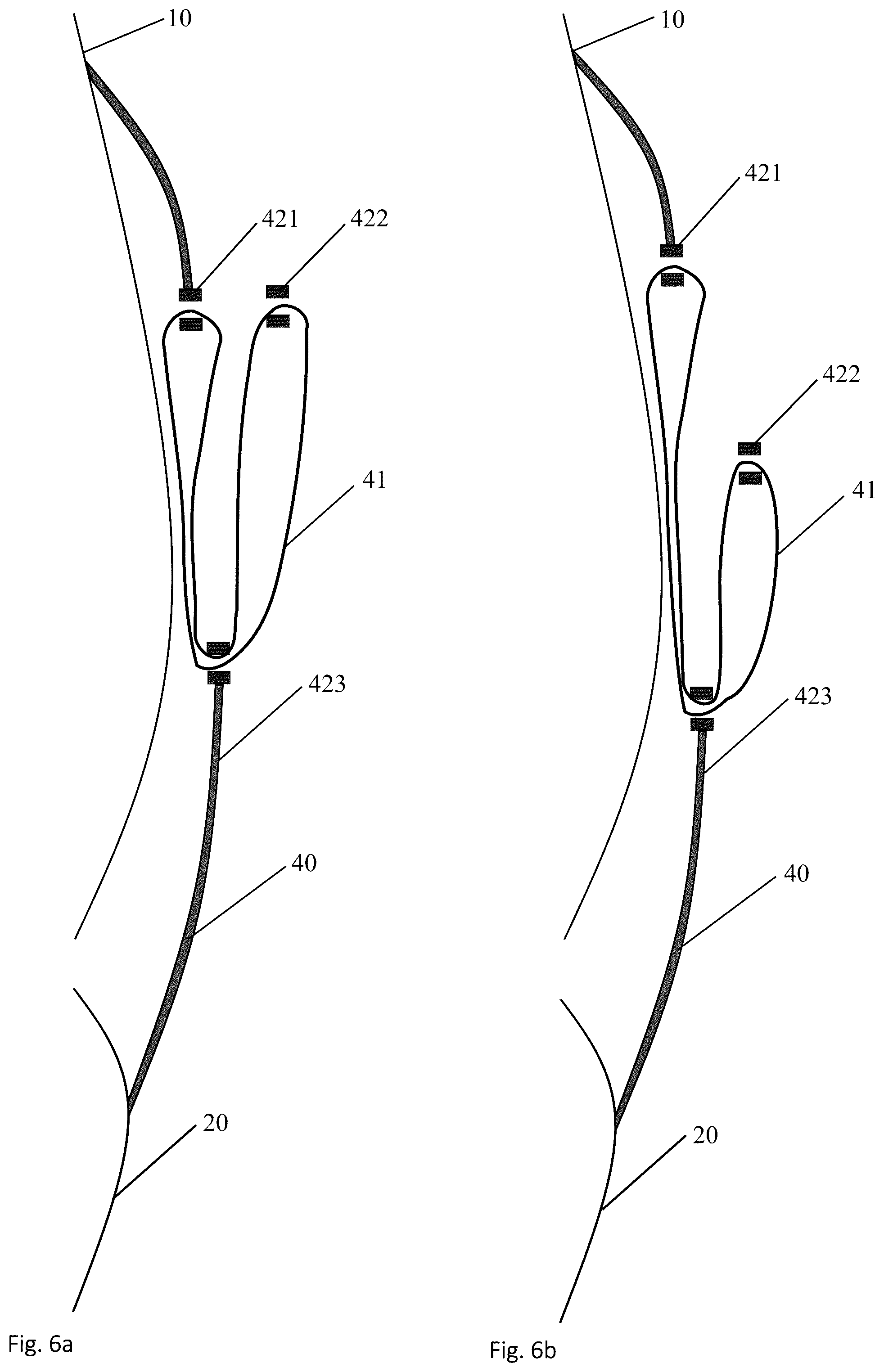 Patent US12396875 Figure 6 – Body support device, the use of it and a method of handling loads