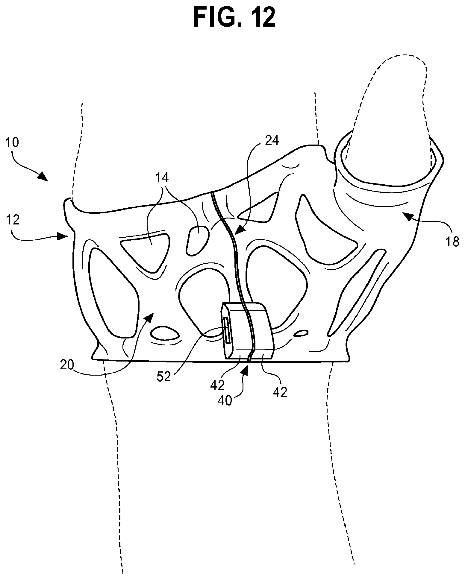 Patent US12396877 Figure 8 – Customizable fitted apparatus
