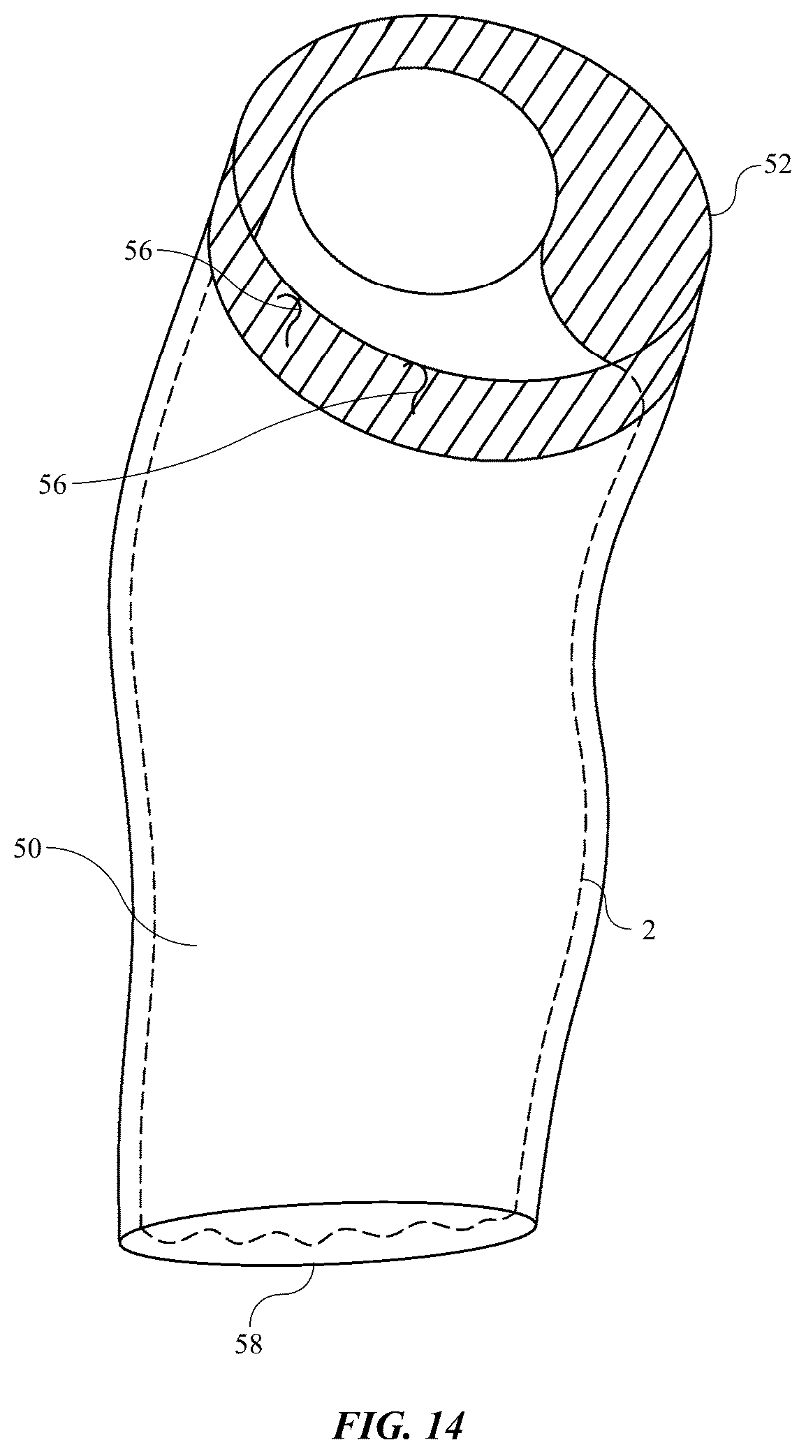 Patent US12396881 Figure 11 – Wearable urinary collection apparatus