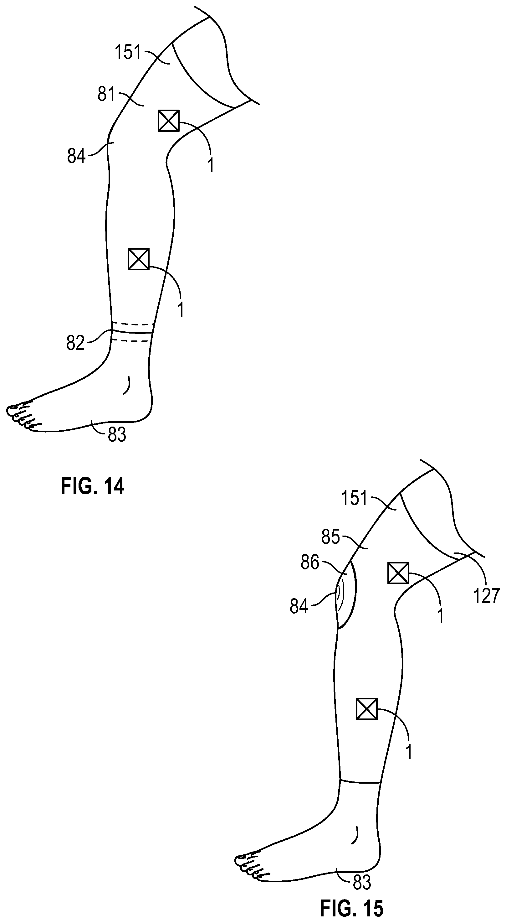 Patent US12396882 Figure 7 – Thermoregulation devices and methods