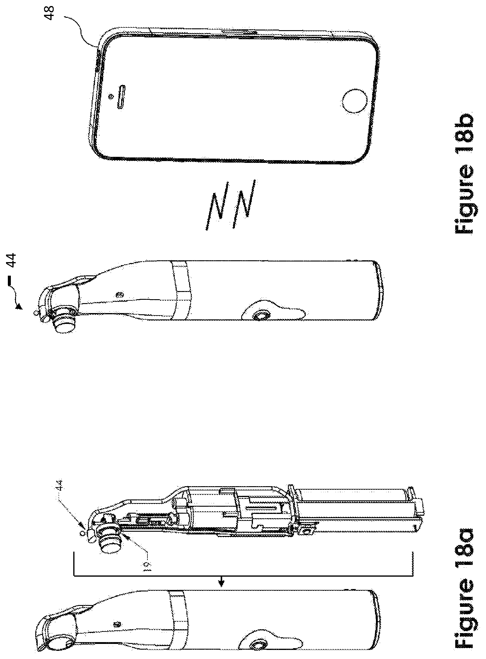 Patent US12396884 Figure 11 – Device and method for stimulating the meibomian glands of the eyelid