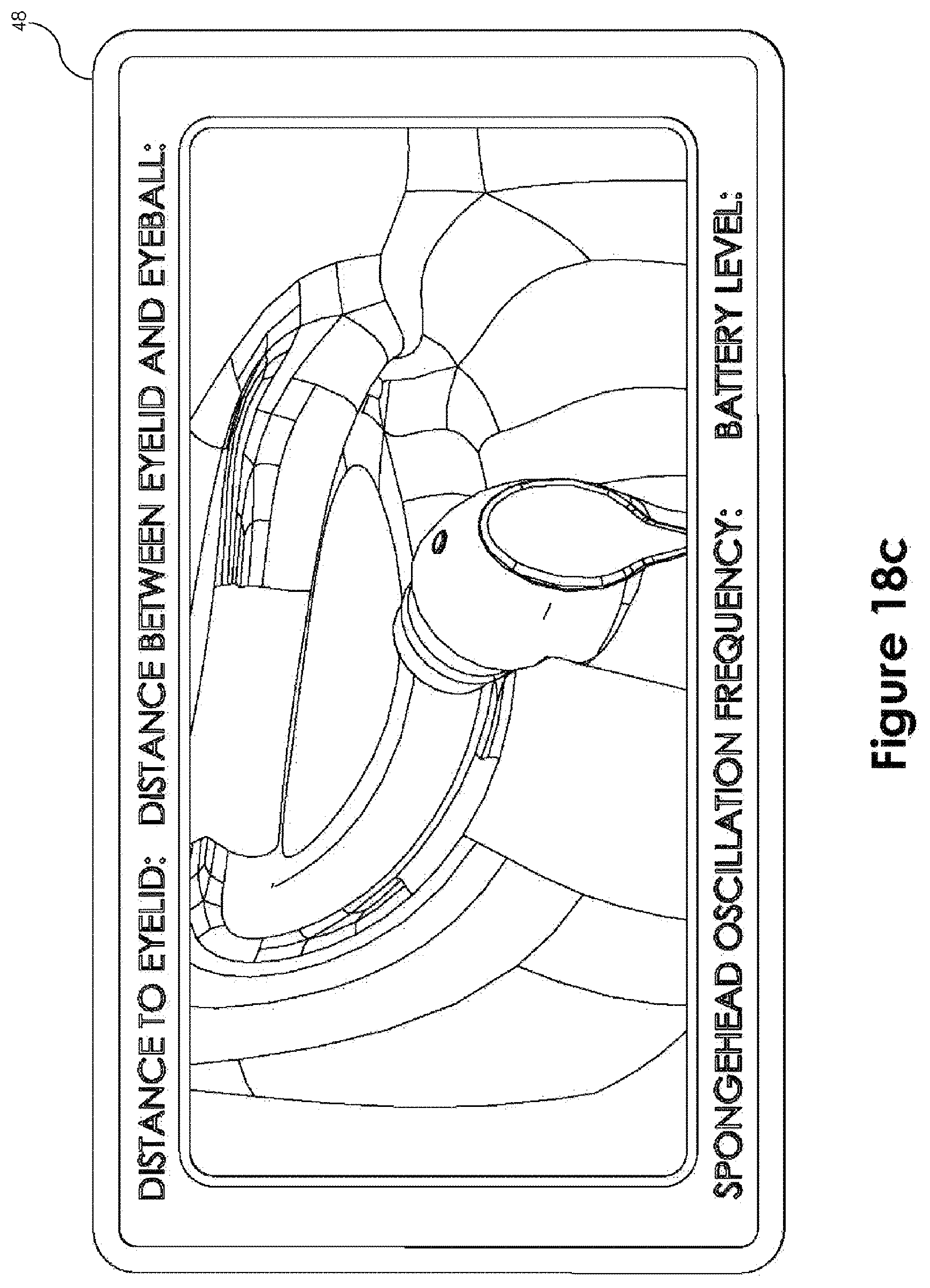 Patent US12396884 Figure 12 – Device and method for stimulating the meibomian glands of the eyelid