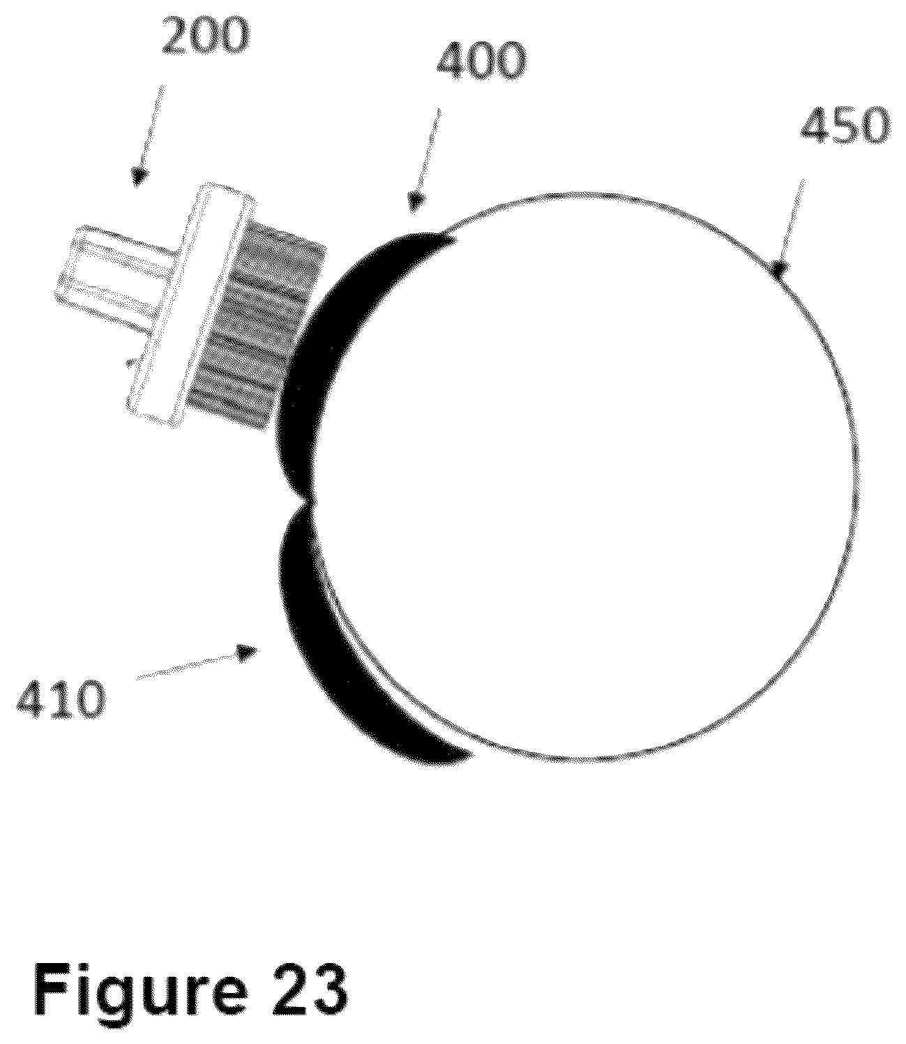 Patent US12396884 Figure 17 – Device and method for stimulating the meibomian glands of the eyelid