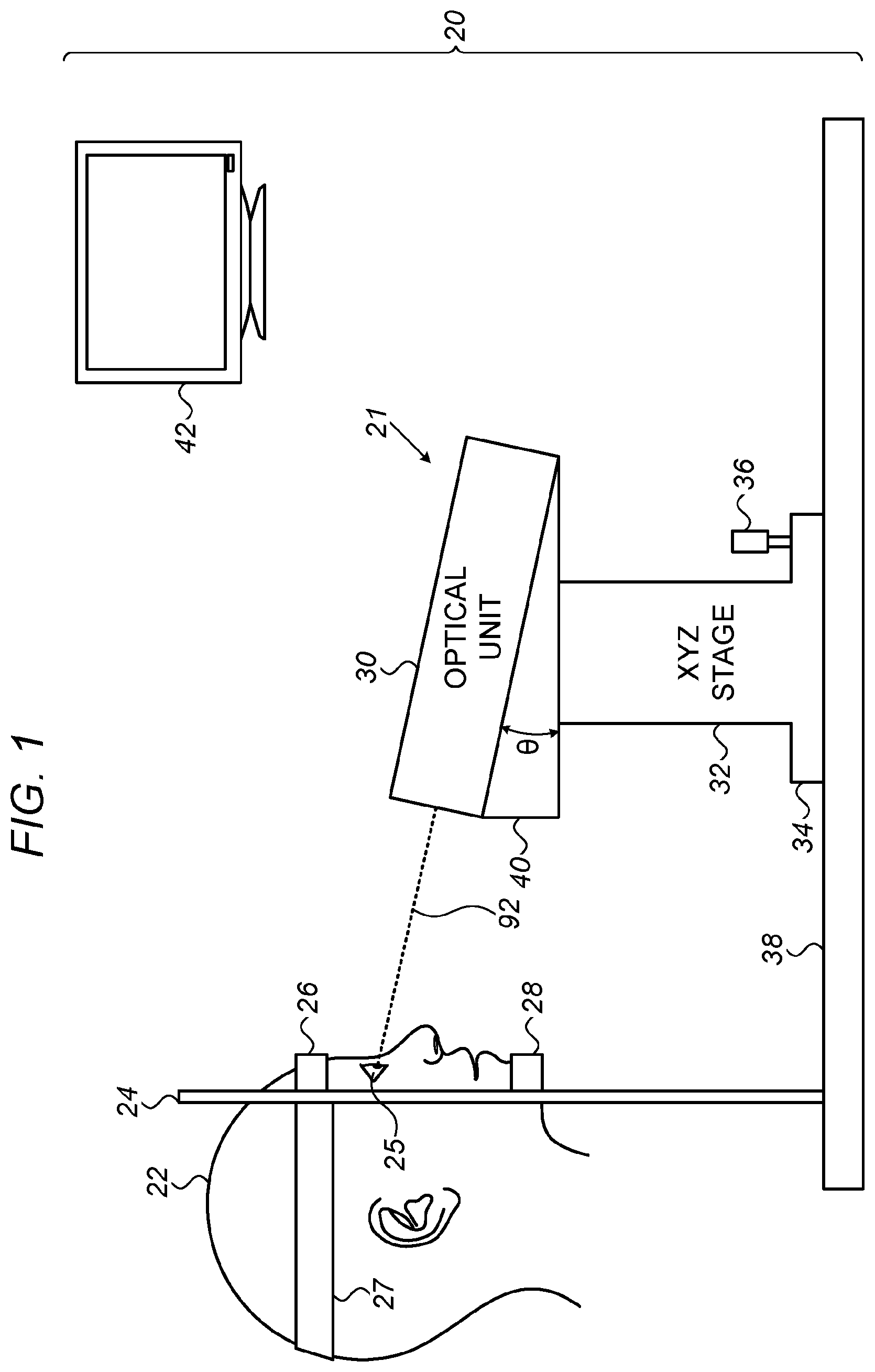 Patent US12396886 Figure 1 – Automated capsulotomy