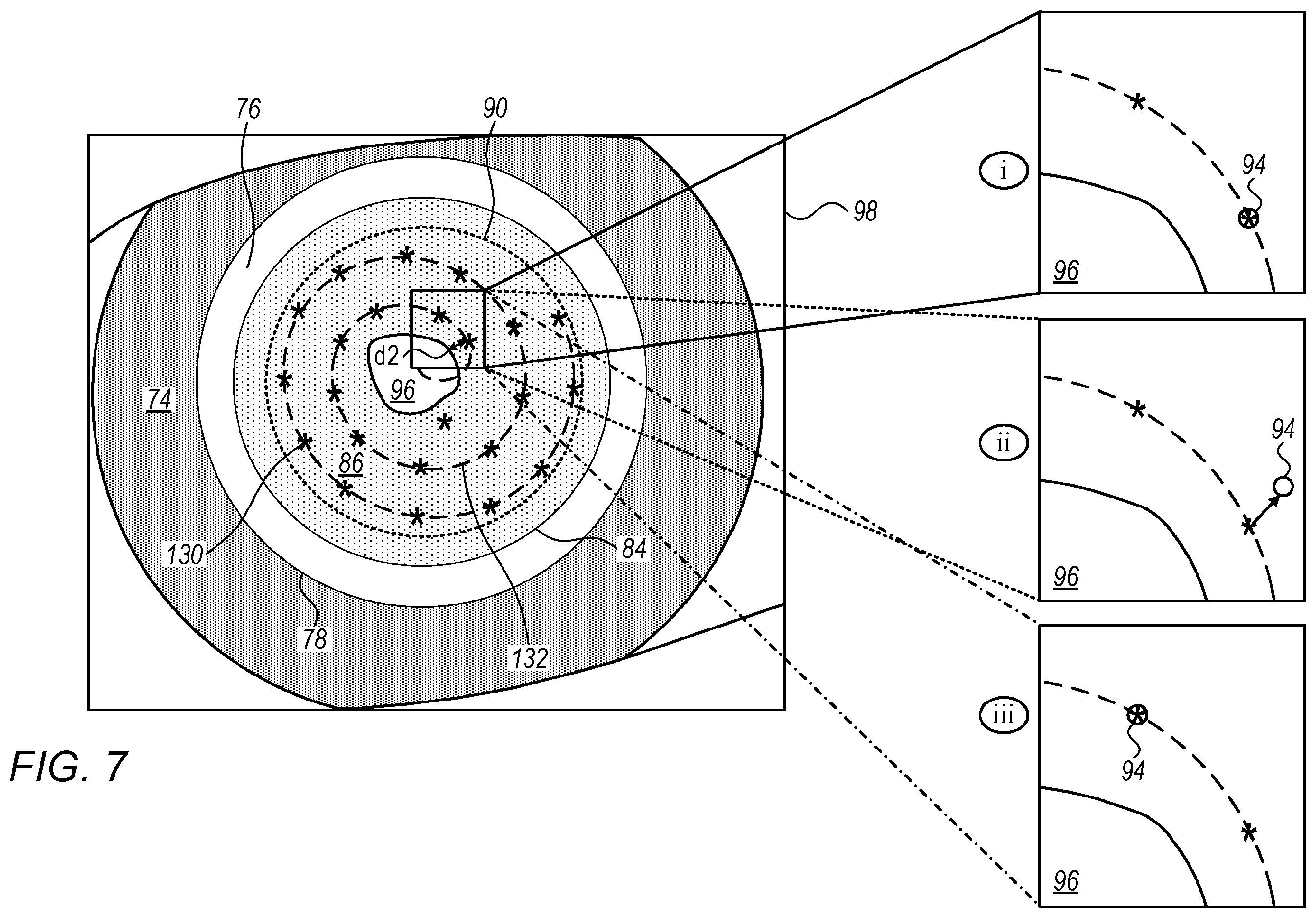 Patent US12396886 Figure 6 – Automated capsulotomy