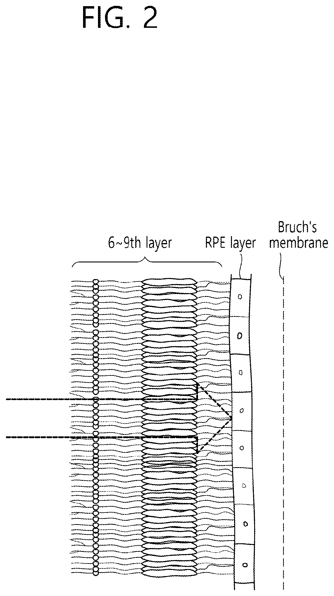 Patent US12396887 Figure 2 – Ophthalmic treatment device and method for driving same