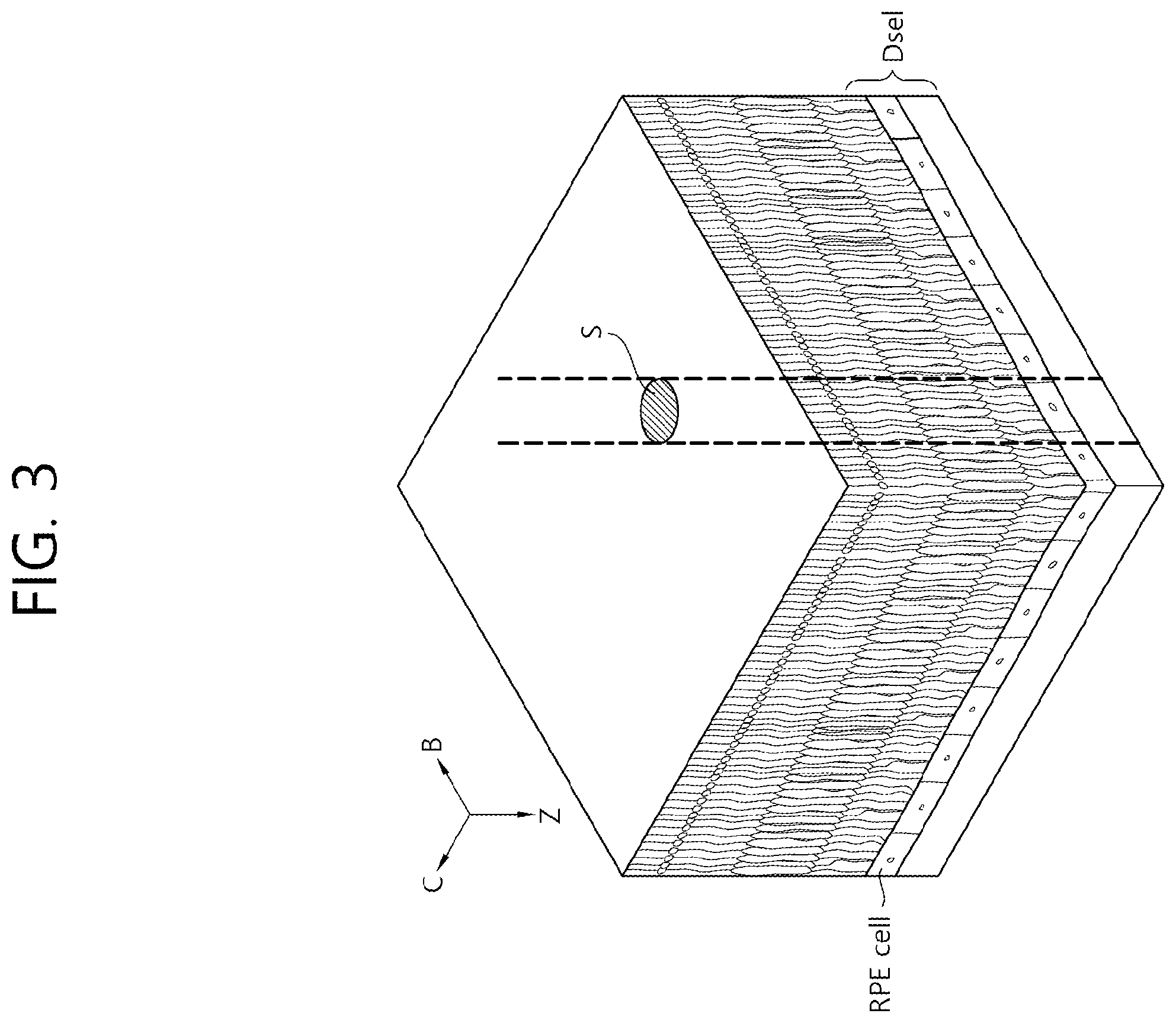 Patent US12396887 Figure 3 – Ophthalmic treatment device and method for driving same