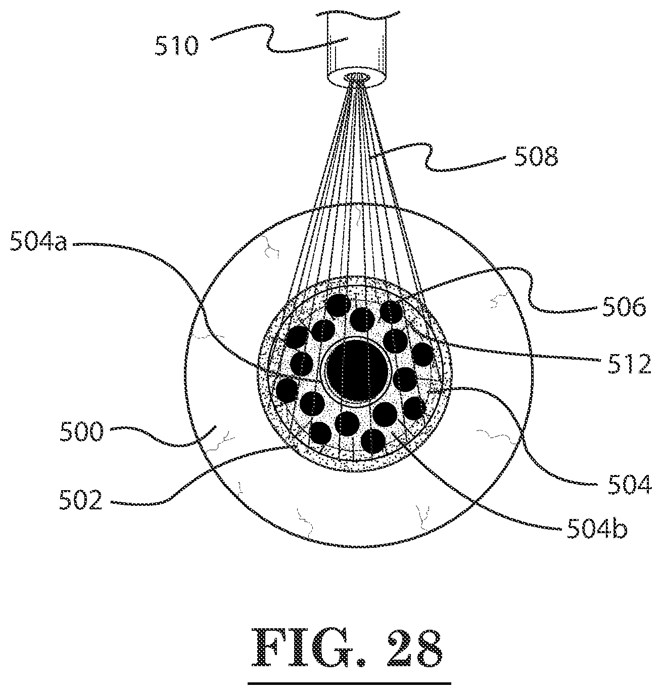 Patent US12396889 Figure 15 – Lamellar corneal autologous or homologous graft in refractive surgery