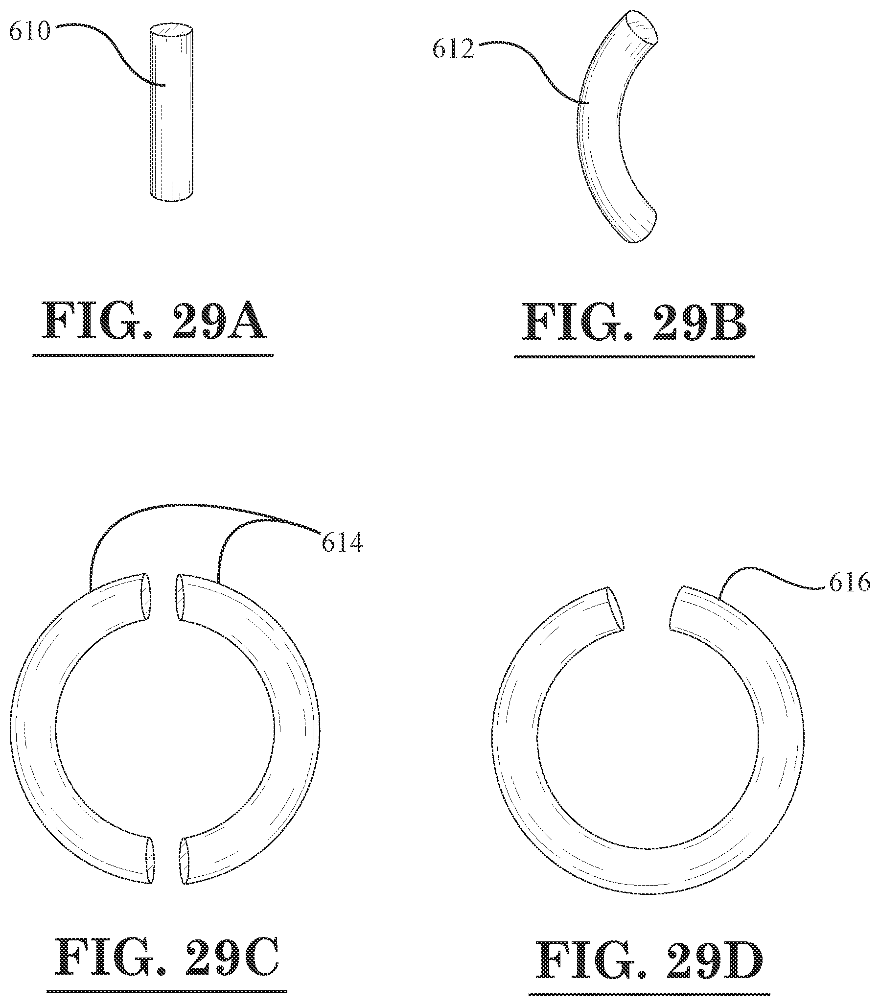 Patent US12396889 Figure 16 – Lamellar corneal autologous or homologous graft in refractive surgery