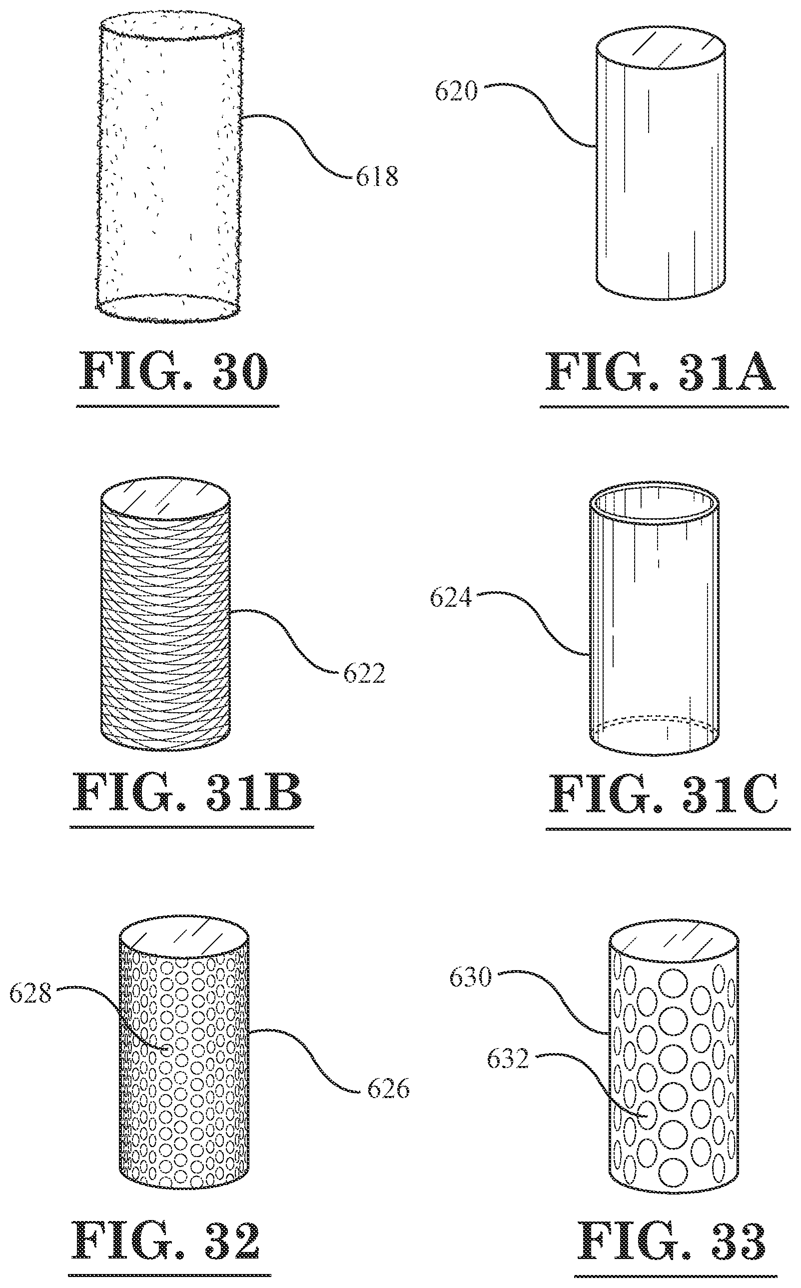 Patent US12396889 Figure 17 – Lamellar corneal autologous or homologous graft in refractive surgery