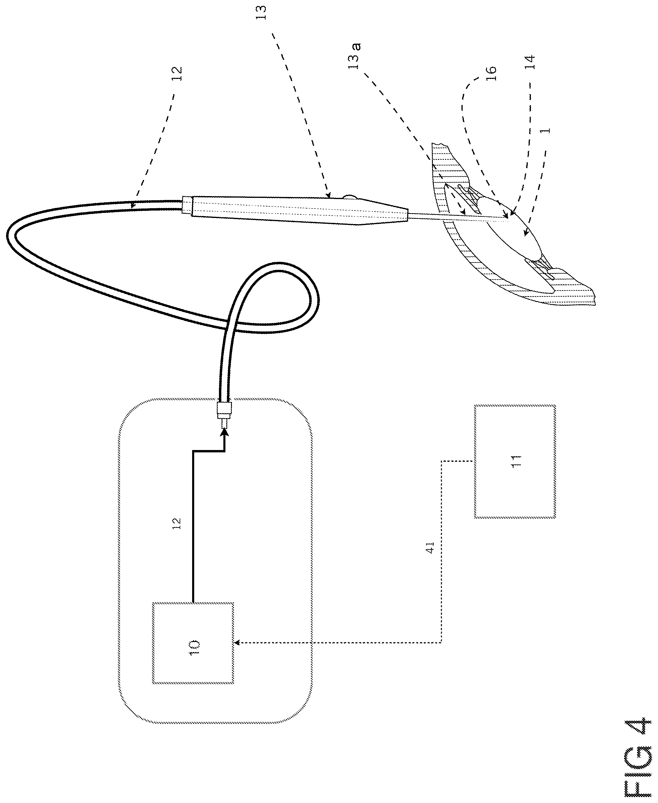 Patent US12396891 Figure 4 – Laser apparatus for treatment of a cataractous lens