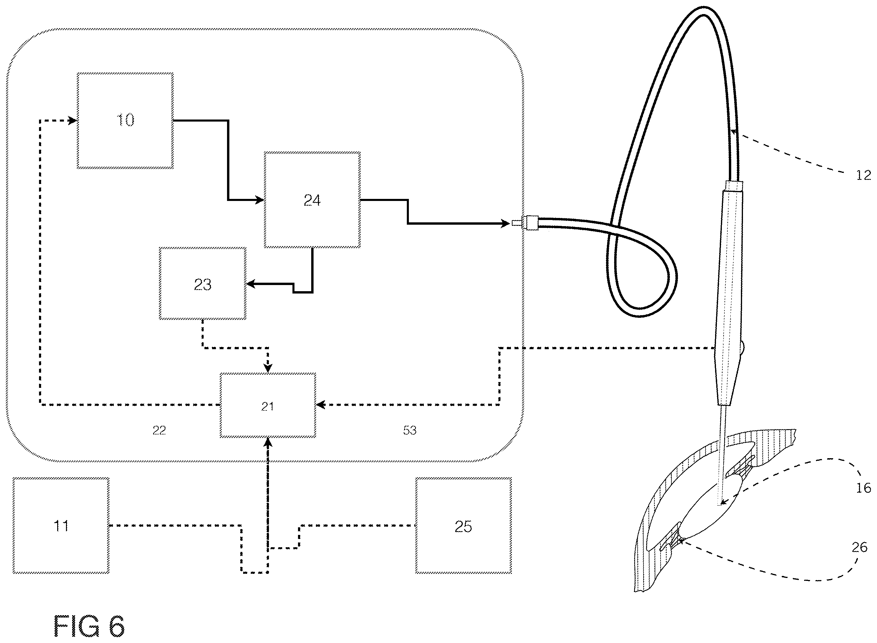 Patent US12396891 Figure 6 – Laser apparatus for treatment of a cataractous lens